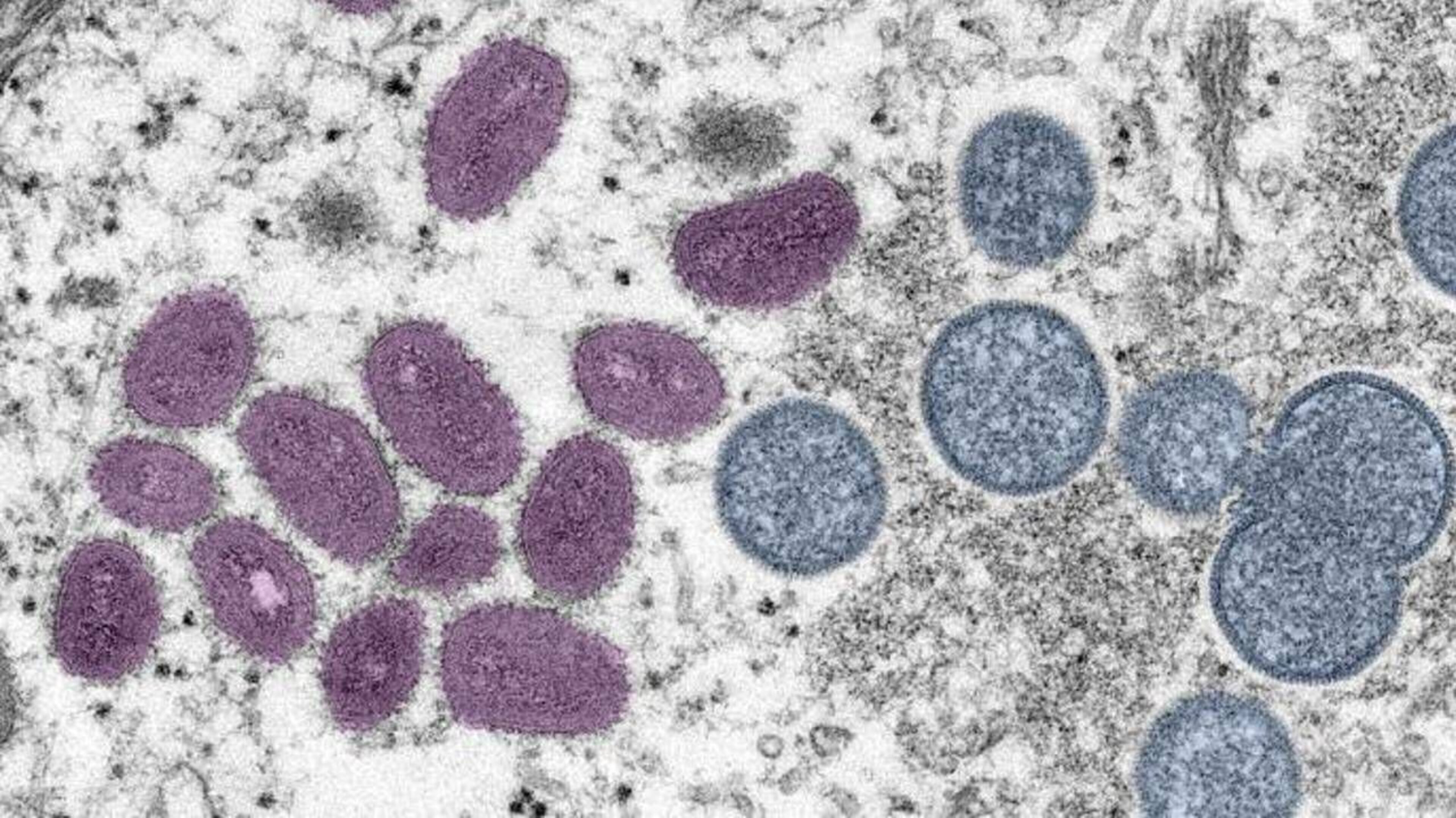 CDC activated its emergency operations center to respond to monkeypox outbreak, renamed mpox.