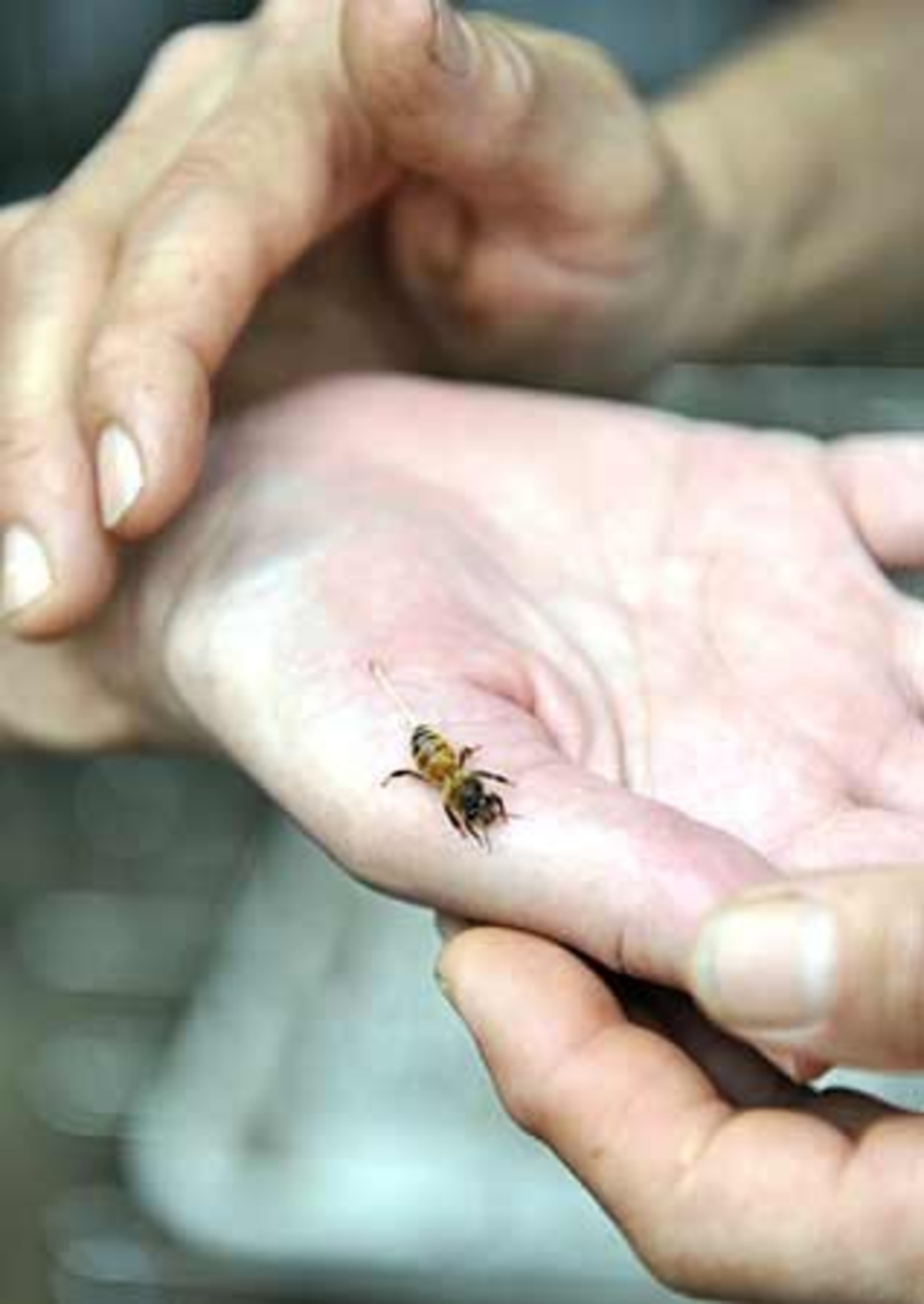 Cindy Bee says that venom from the Bee's sting will bring white blood cells to the area and help heal it.