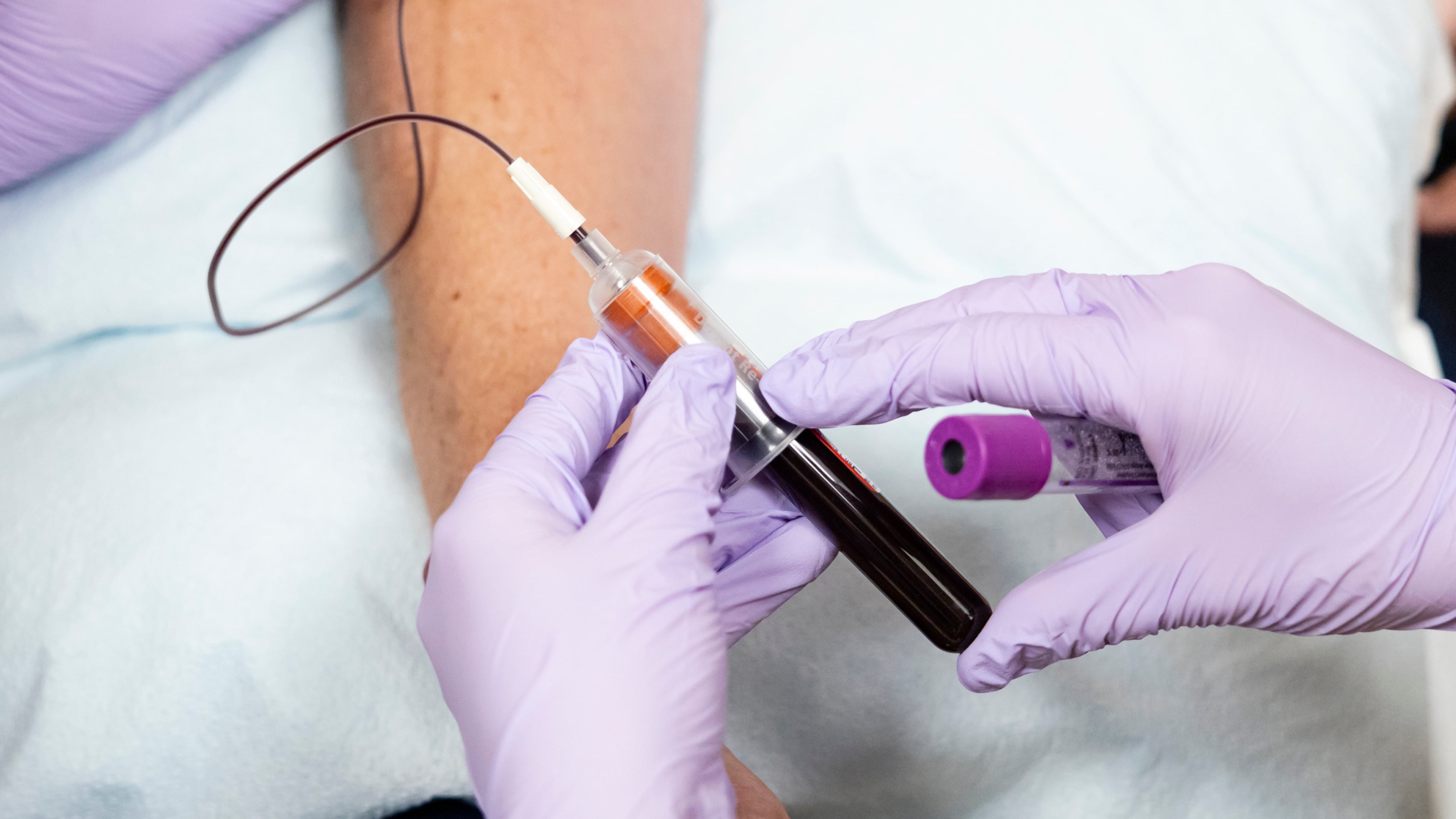 A blood sample can be used to measure A1C, a test that offers a picture of average blood sugar levels over the past two to three months. (Eva Marie Uzcategui/The New York Times)