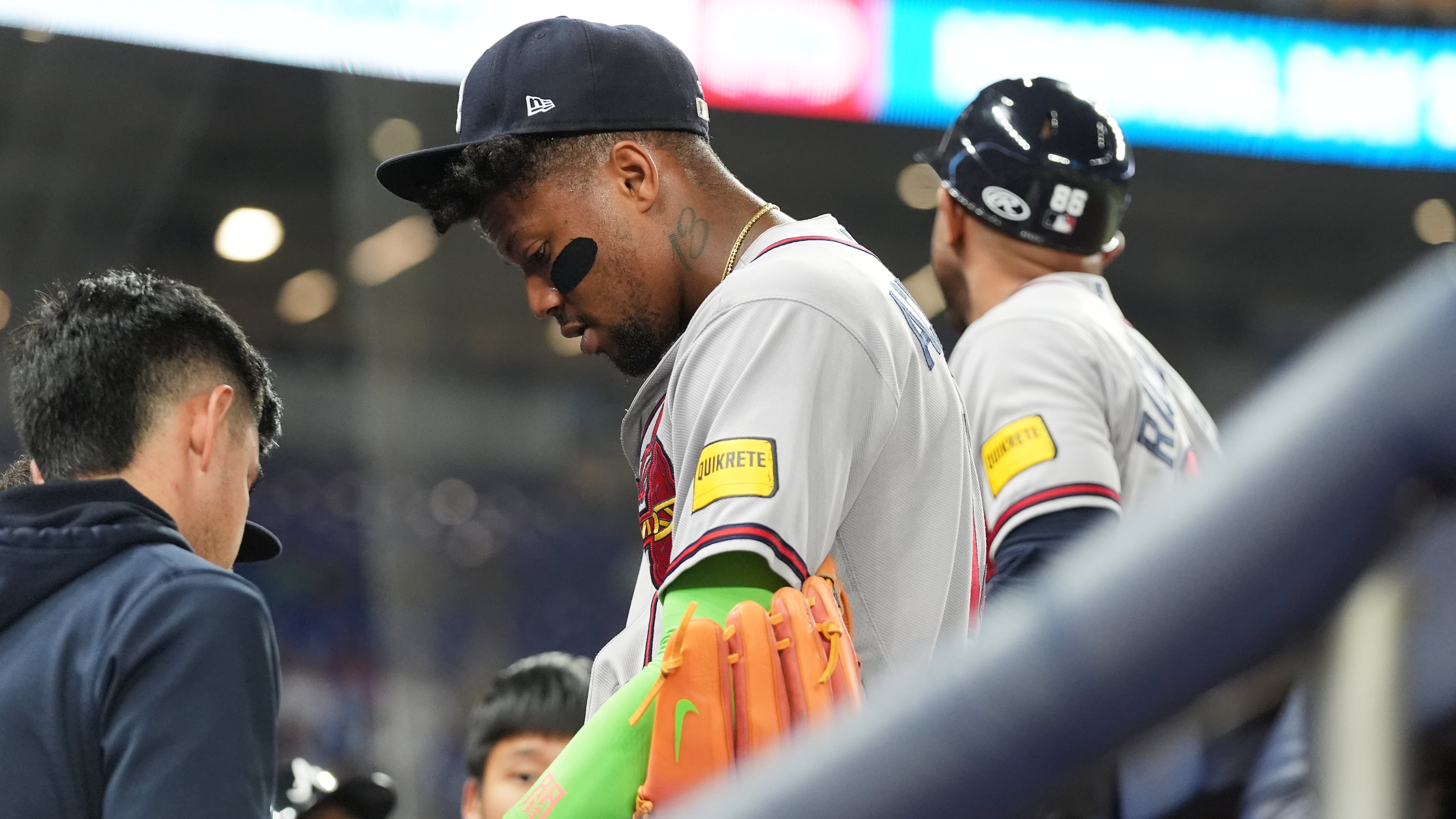 Atlanta Braves' Ronald Acuna, center, has his finger looked at during the fifth inning of a baseball game against the Miami Marlins, Thursday, May 21, 2026, in Miami. (Lynne Sladky/AP)