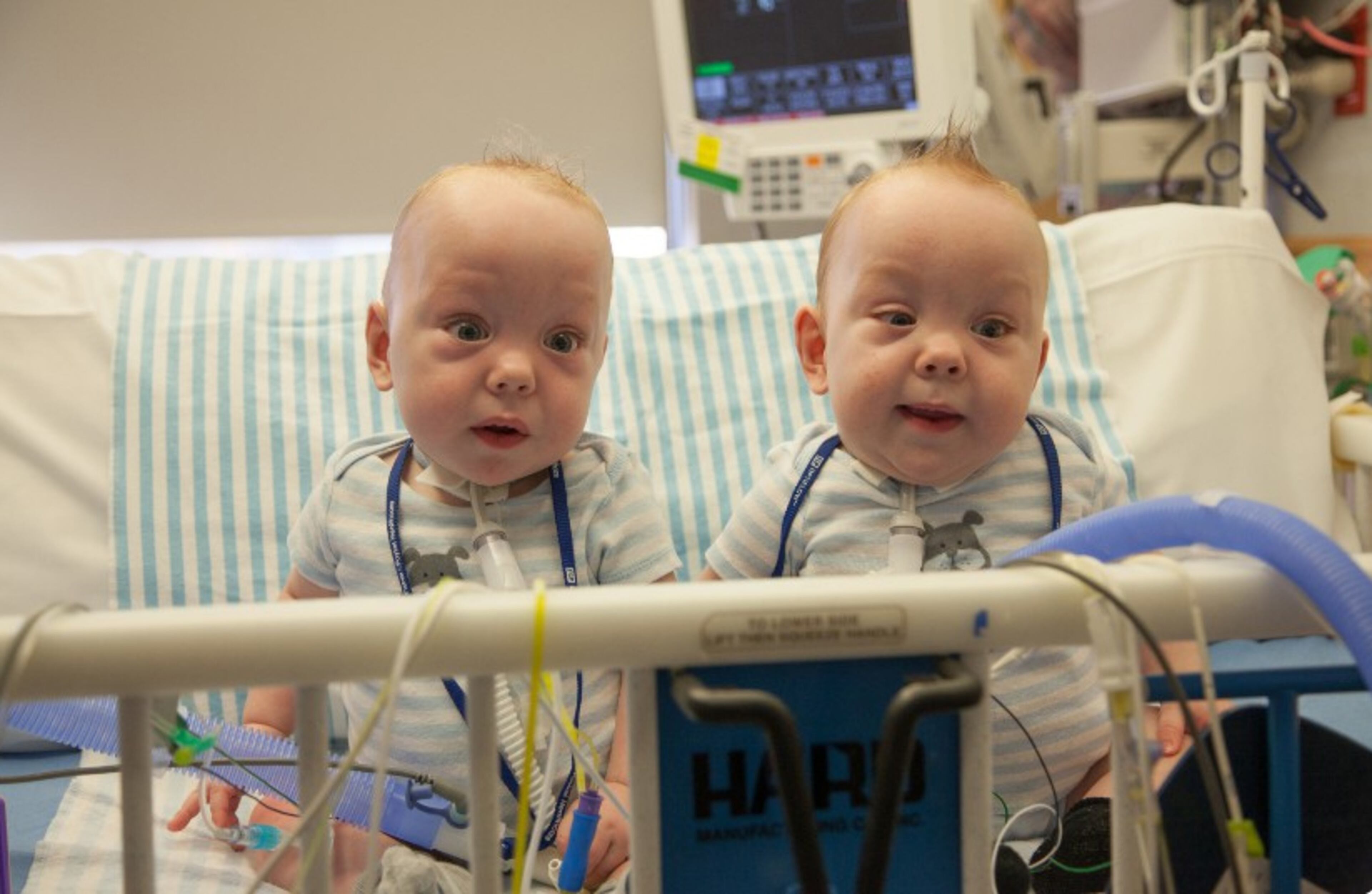 From left, Owen and Emmett Ezell at the Medical City Children's Hospital were released today after the conjoined twins were separated on August 24. Ezell Family/Medical City Children's Hospital
