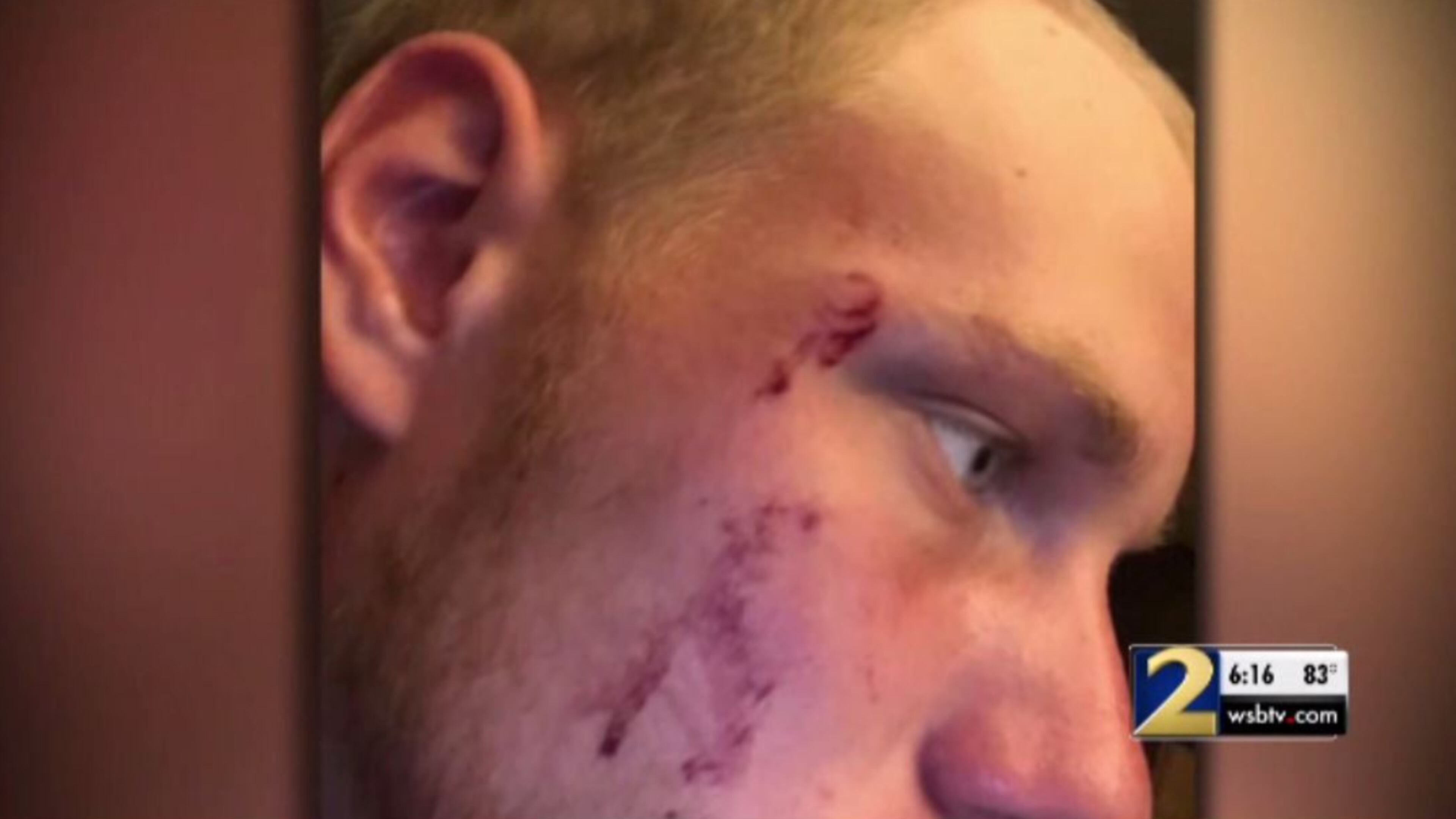 A bullet skimmed Jacob Chase's temple after he ran after an alleged car burglar.