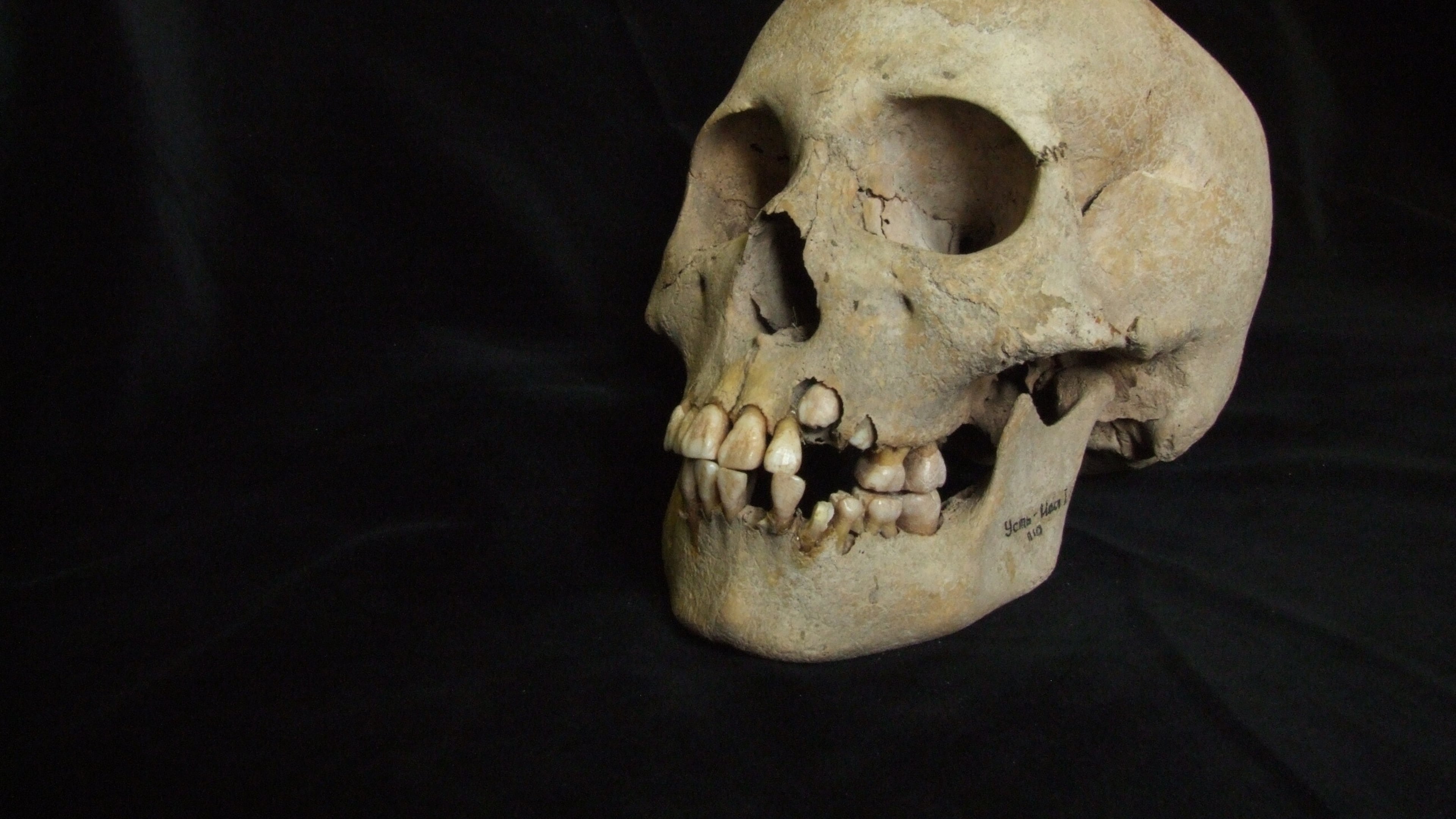This 2006 image from Angela Lieverse shows the skull of a young girl who was buried with victims of the plague in Siberia. (Angela Lieverse via AP)
