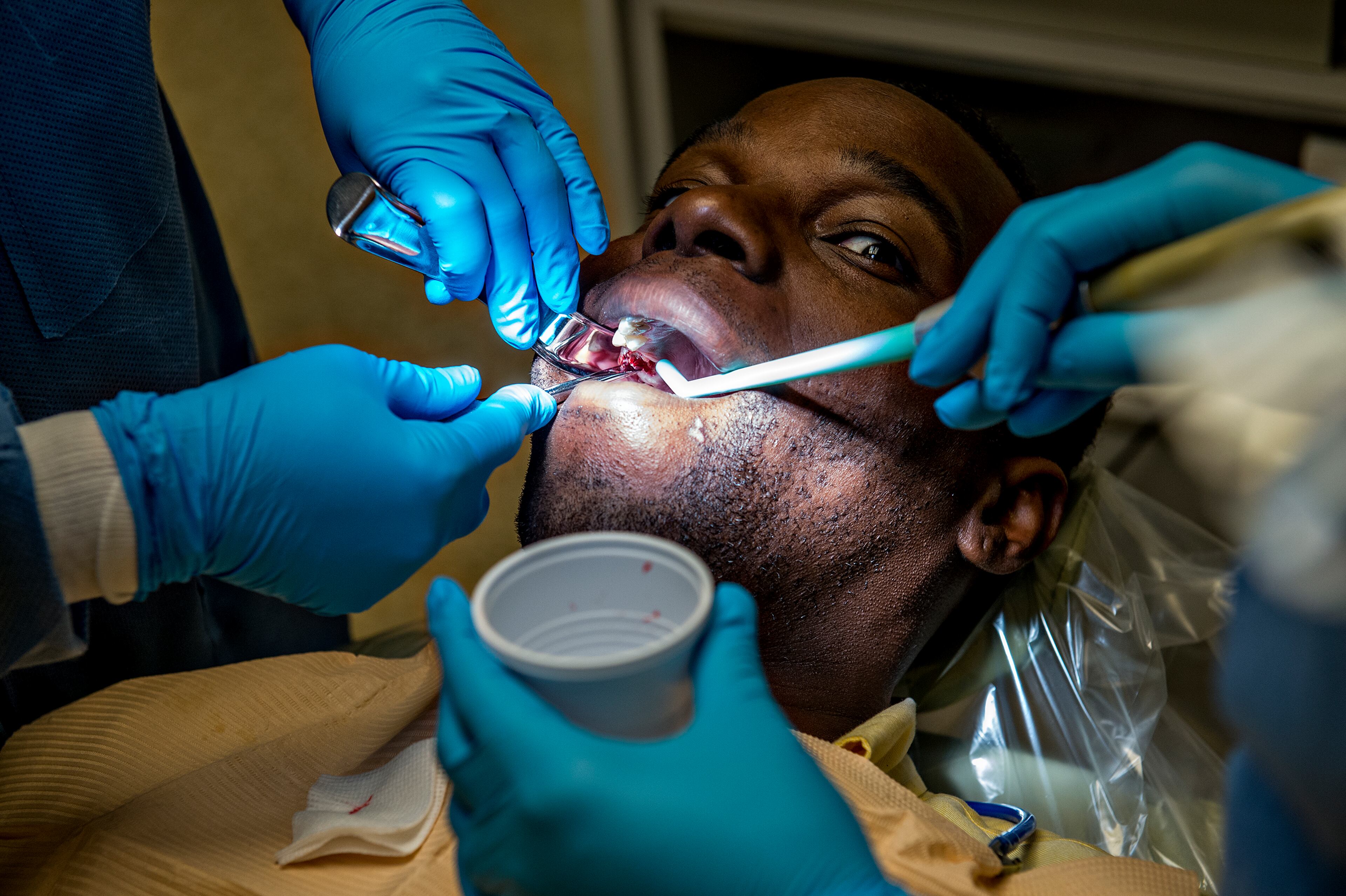 Dr. Katrina Schuler-Bacon (left hands) and DaJanea Rogers (right hands) pull one of Marcet Love's teeth at the Mercy Care free dental clinic in Atlanta on Tuesday, May 19. JONATHAN PHILLIPS / SPECIAL