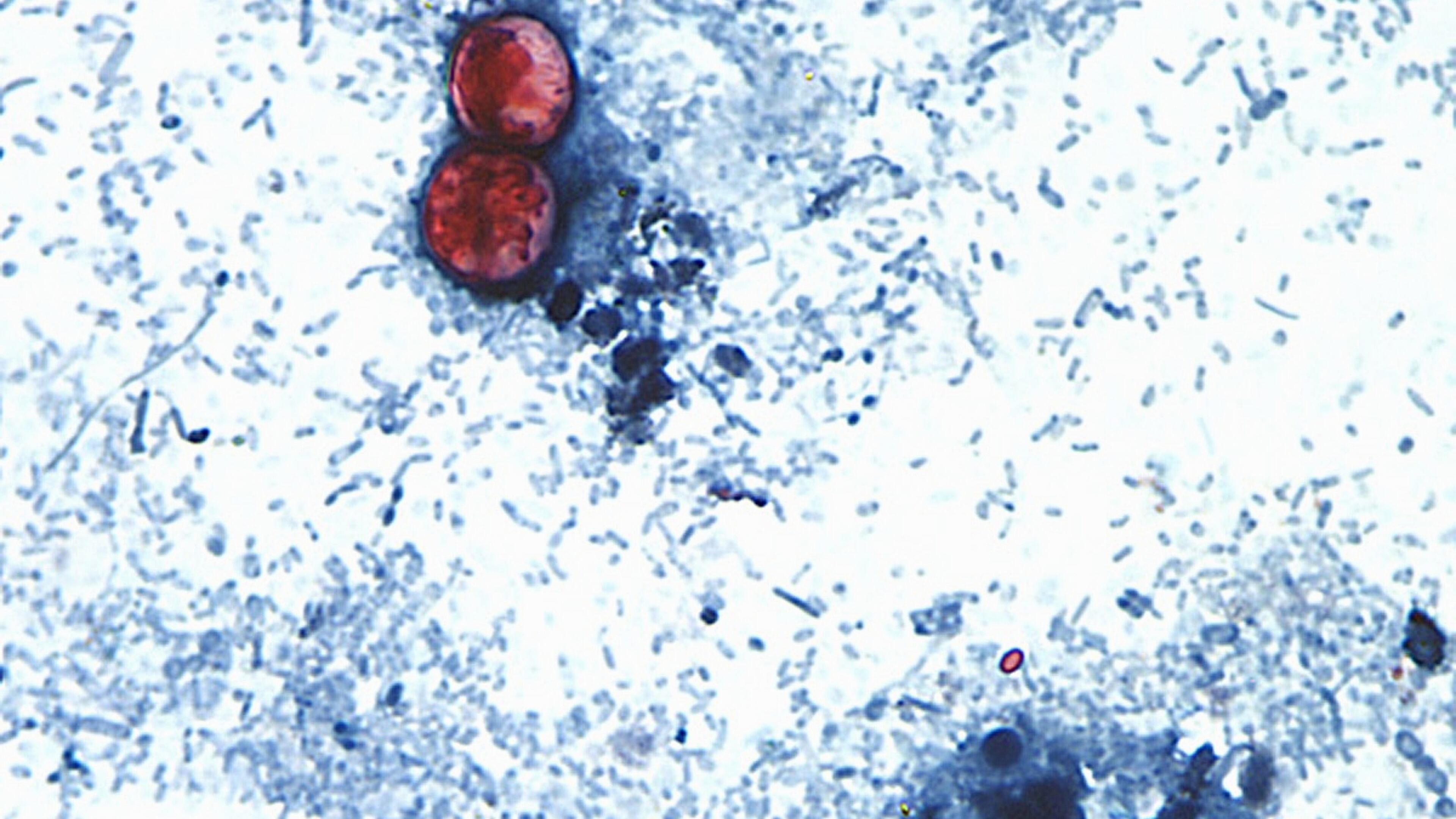 This undated photo taken through a microscope shows cyclospora cayetanensis oocysts. An outbreak of the diarrhea-causing parasite has spurred warnings from health officials. (Centers for Disease Control and Prevention via AP File)