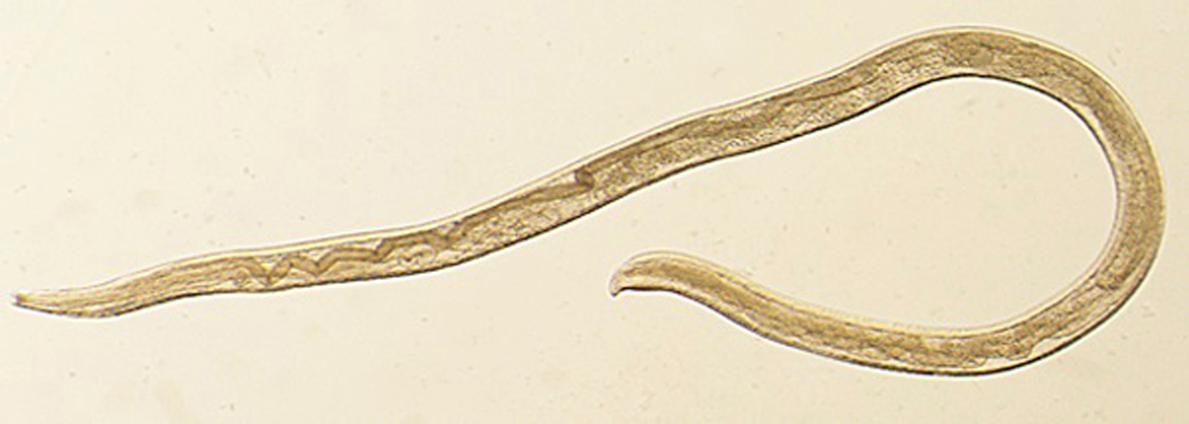 This undated photo provided by the Centers for Disease Control and Prevention (CDC) shows Thelazia gulosa, a type of eye worm seen in cattle in the northern United States and southern Canada, but never before in humans. An Oregon woman who had worms coming out of her eye is being called the first known human case of a parasitic infection spread by flies. Fourteen tiny worms were removed from the left eye of the 26-year-old woman in August 2016. Scientists reported the case Monday, Feb. 12, 2018.