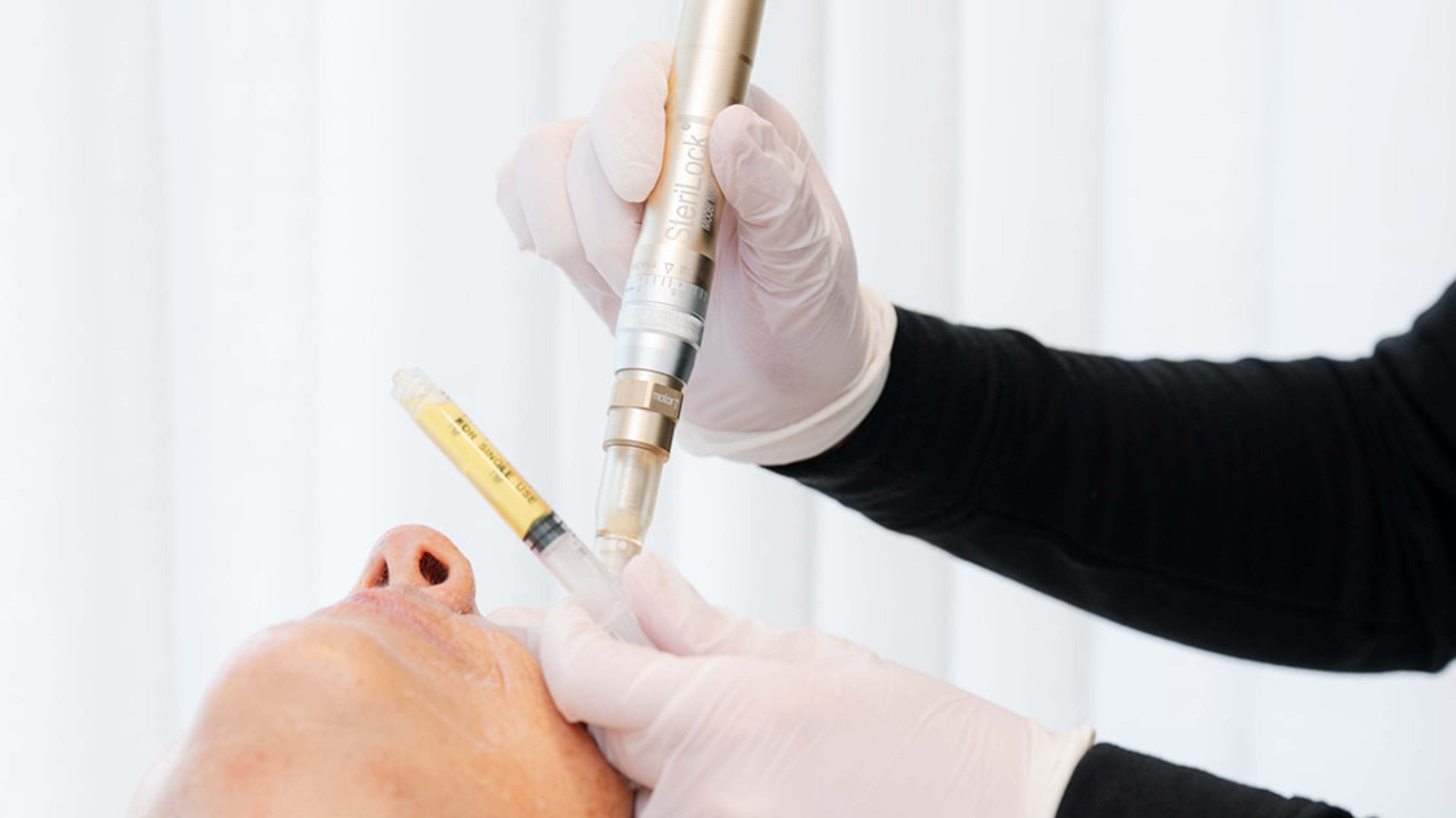 During a PRP facial, platelet-rich plasma — often called “liquid gold” for its regenerative properties — is applied to freshly microneedled skin to encourage healing and radiance.
