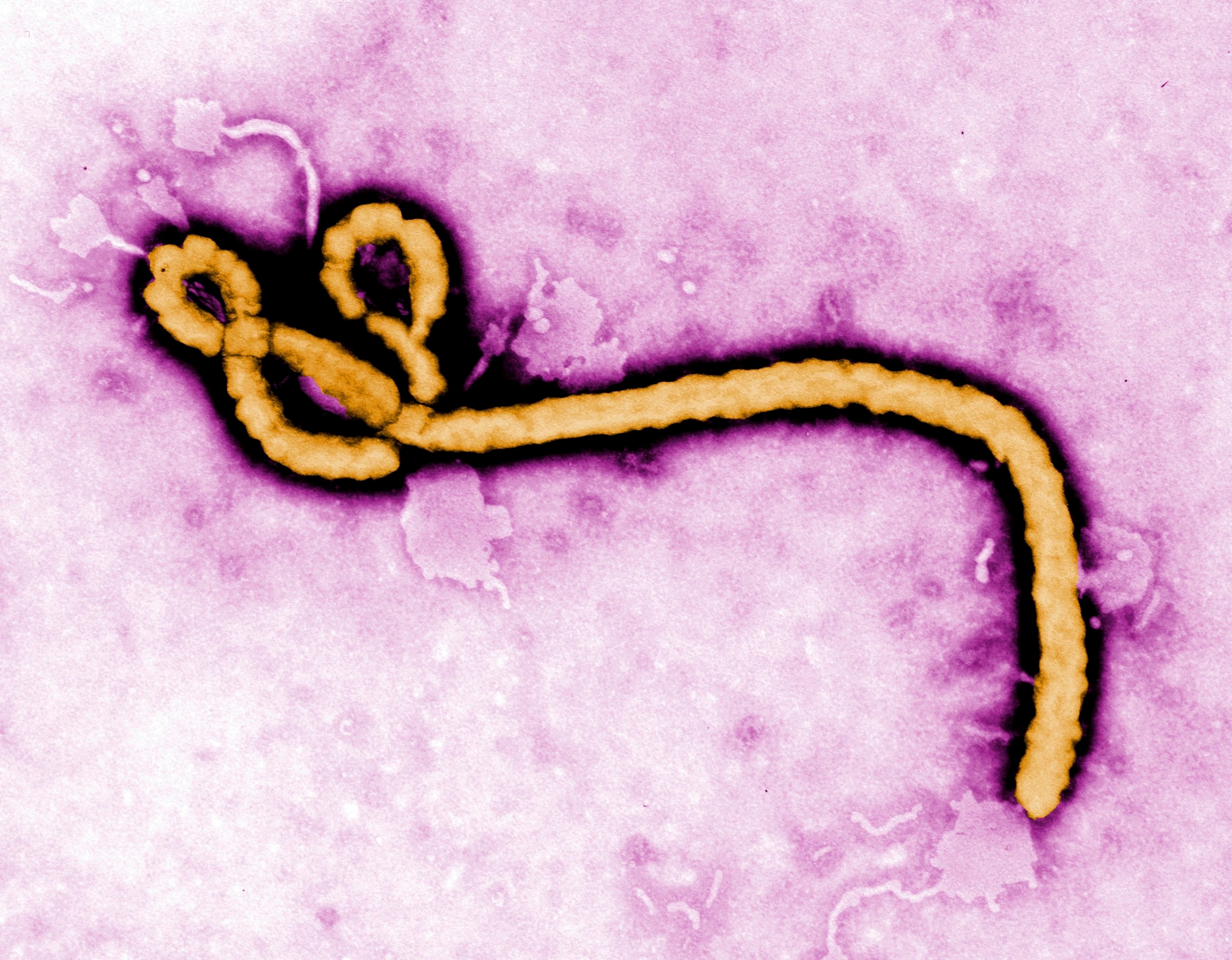 This undated and colorized transmission electron micrograph file image was made available by the Centers for Disease Control and Prevention shows an Ebola virus virion. (Frederick Murphy/CDC via AP, file)