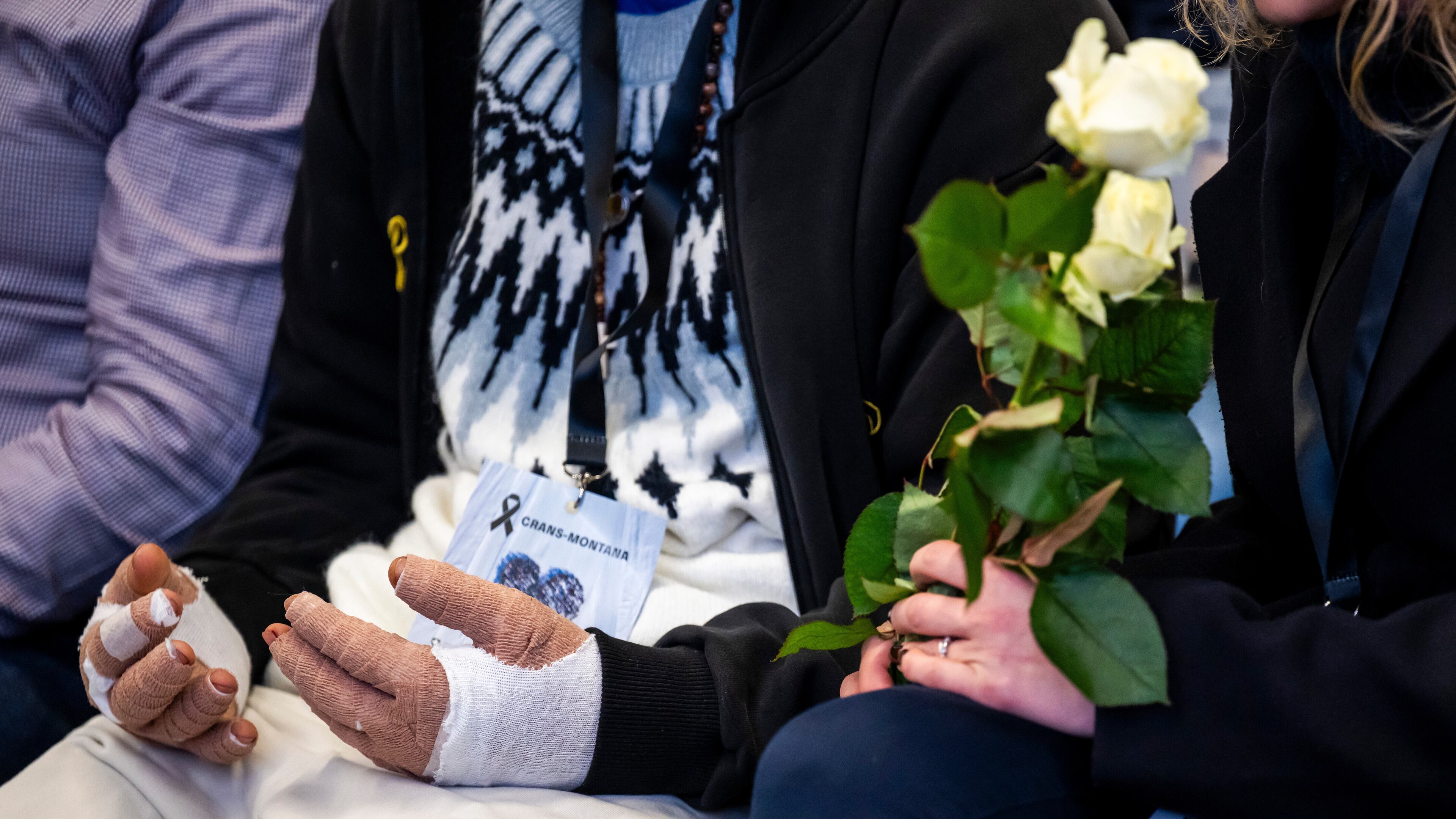A victim with burned hands and relatives attend the official commemorative ceremony for the victims of the deadly fire at the "Le Constellation" bar in Crans-Montana, in Martigny, Switzerland, Friday, Jan. 9, 2026. (Laurent Gillieron/Keystone/Pool via AP)