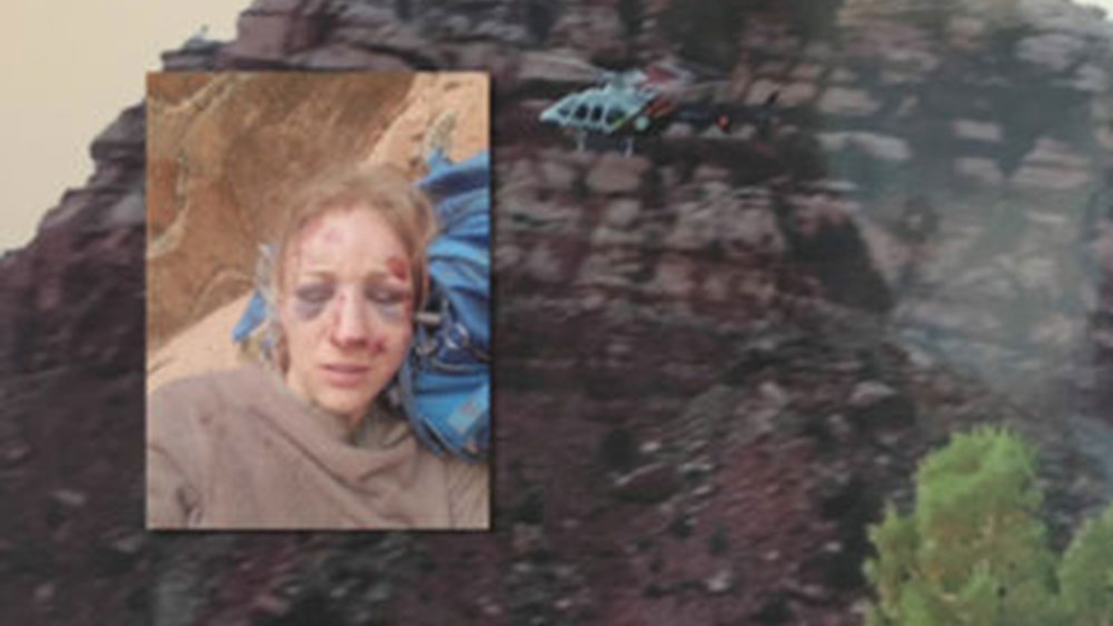 Photo of Amber Kohnhorst after her fall.