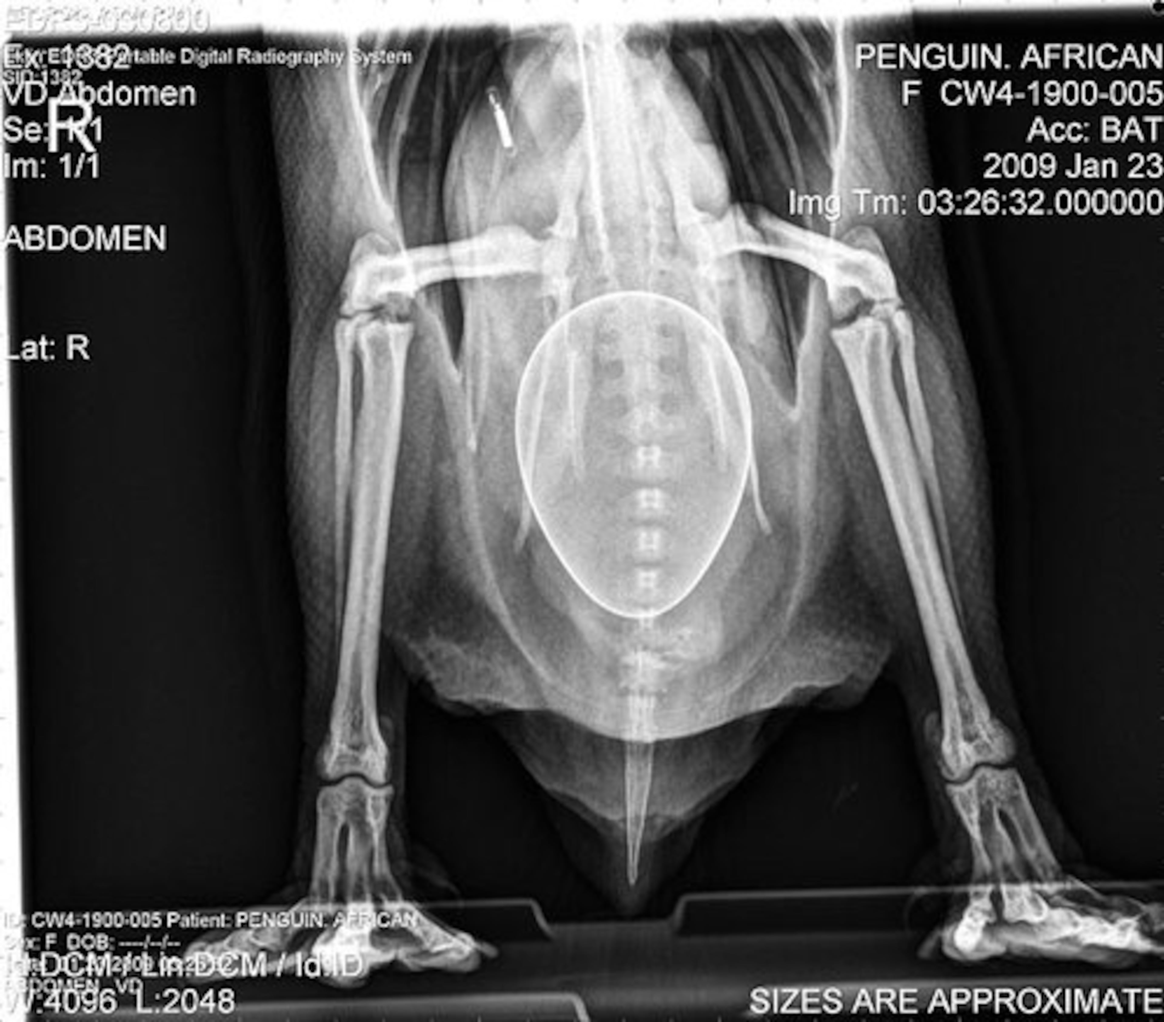 WARNING -- SOME PHOTOS MAY BE CONSIDERED GRAPHIC. This X-ray shows the unfertilized egg inside Bat, a Georgia Aquarium penguin.
