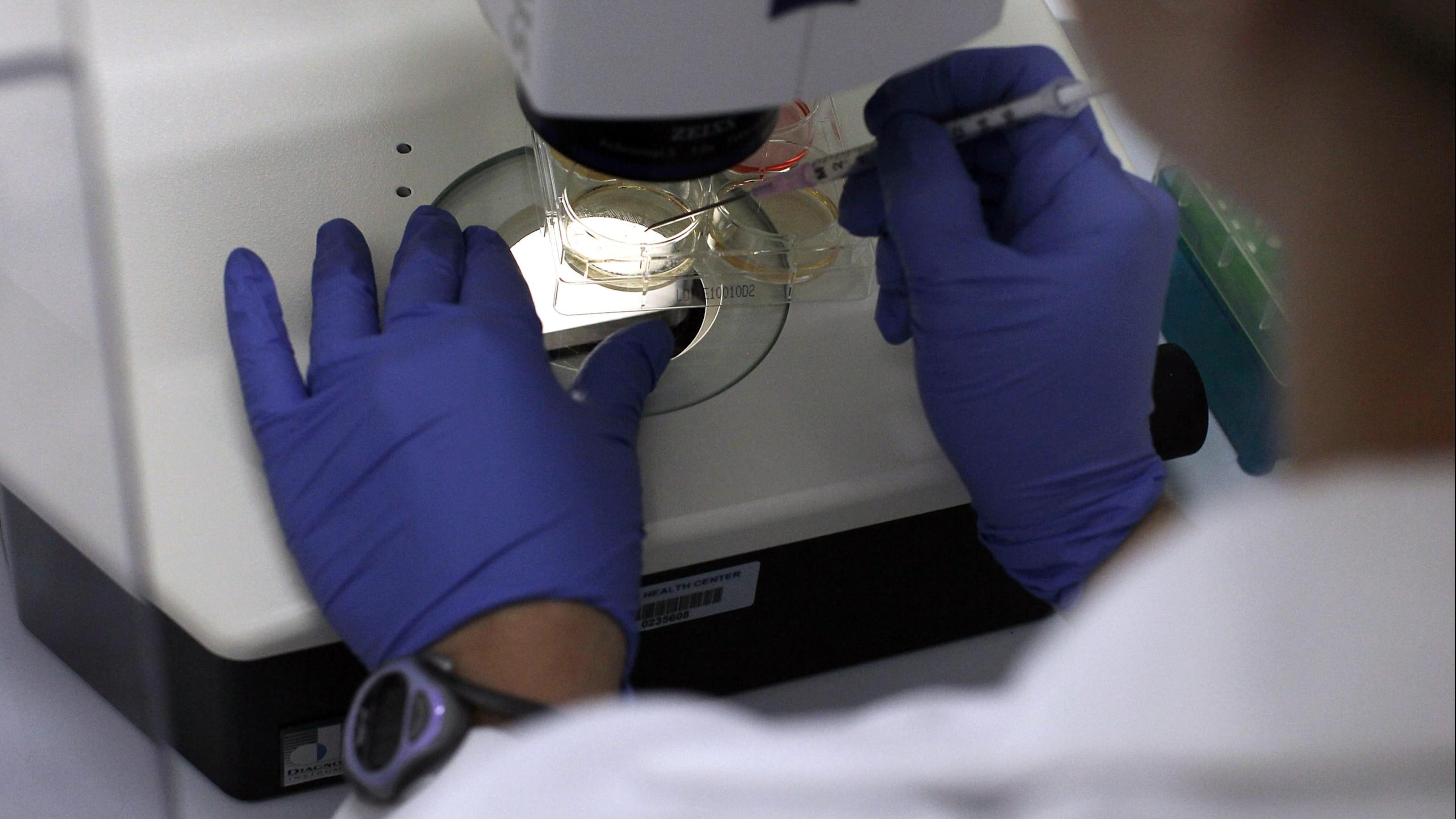 A new study by scientists at the Icahn School of Medicine at Mount Sinai in New York, discovered a link between the most common herpes viruses and Alzheimer’s disease.