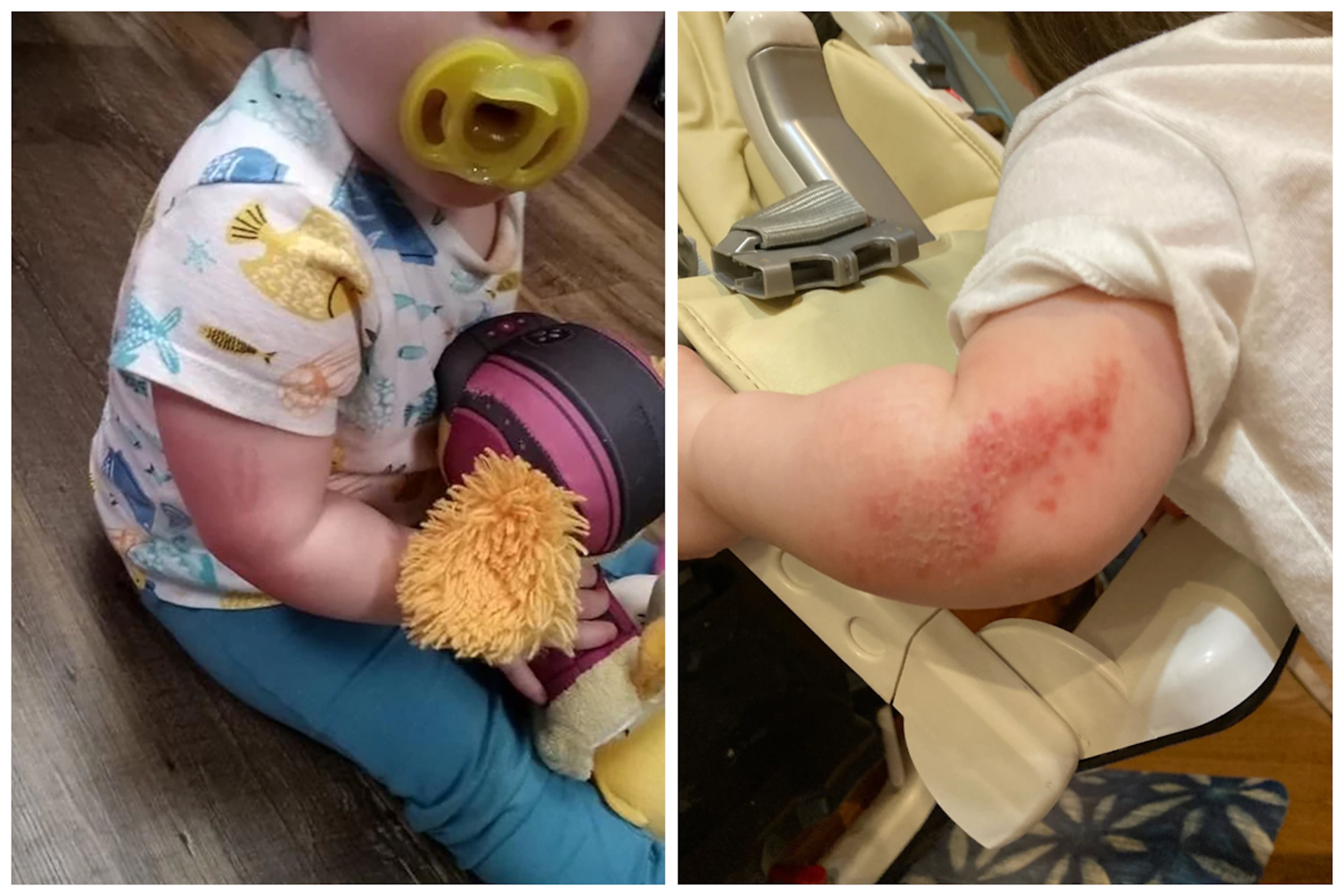 State investigators found that the Scotts’ daughter suffered chemical burns on her arms from bleach left out in her classroom at Oxford Academy Preschool in Powder Springs. Records also show that the daycare director at the time told employees to lie about what happened. (Courtesy of family)