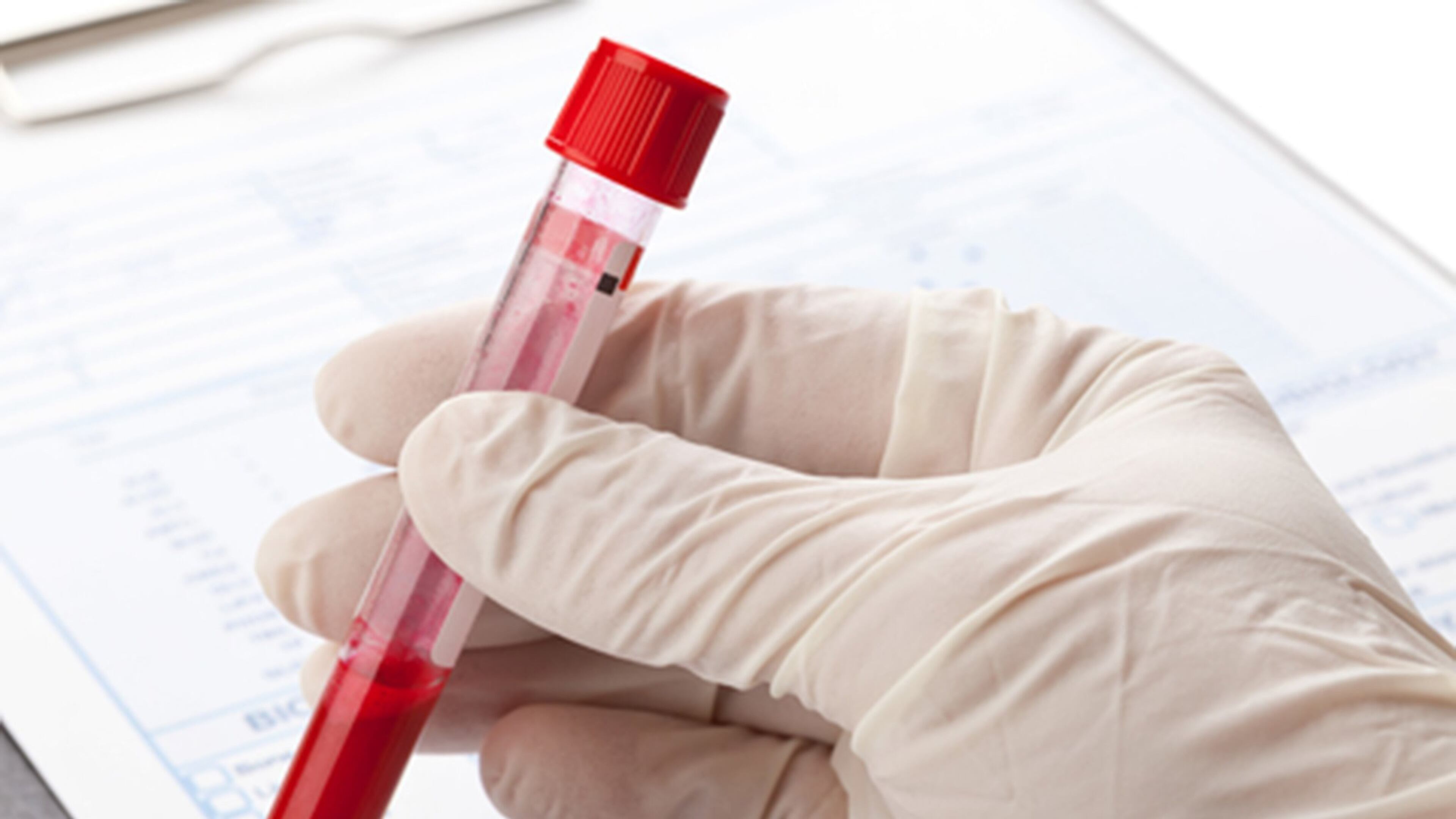 Blood test (Dreamstime/TNS)