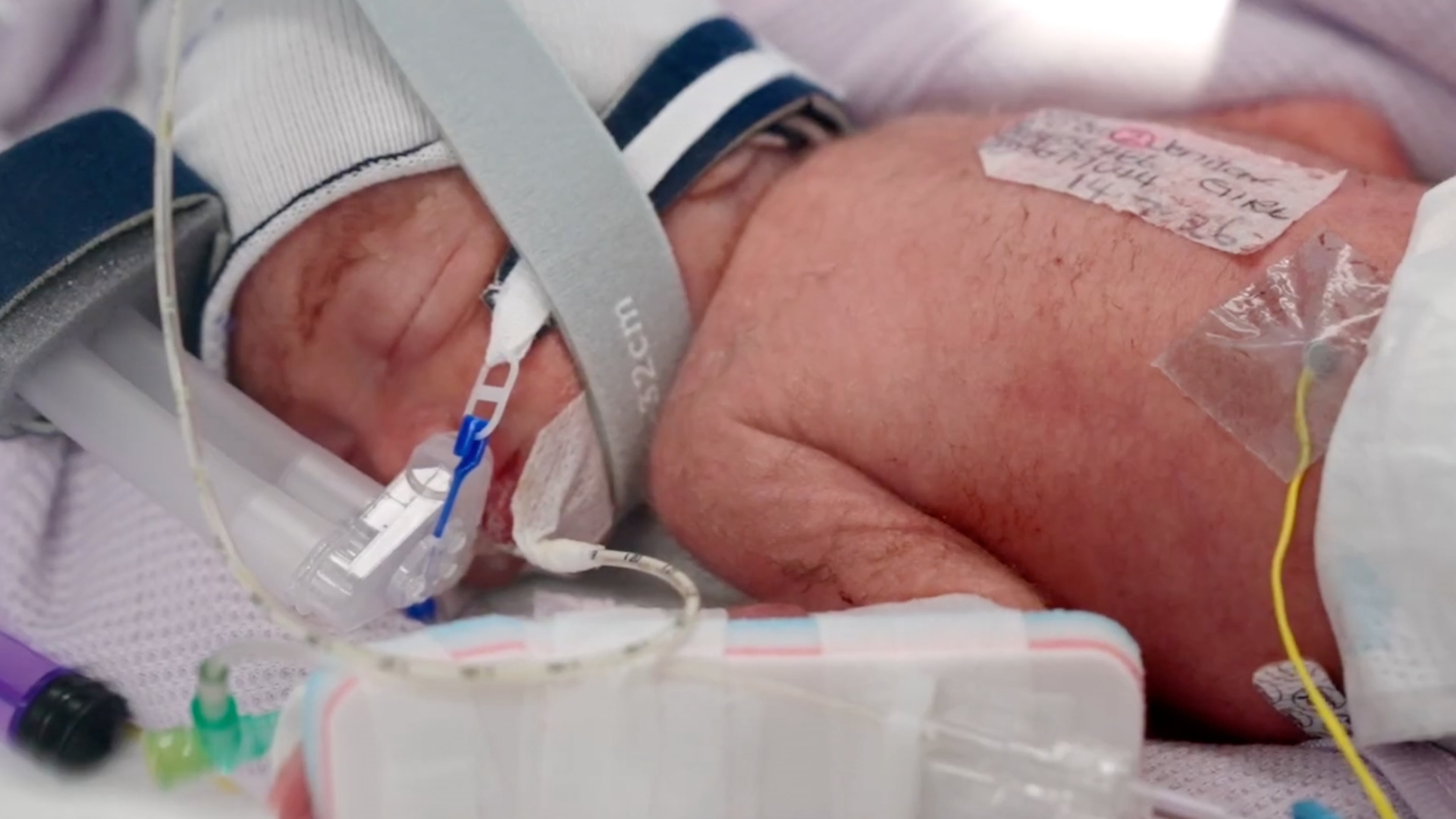 In this image taken from video taken on July 15, 2026, one of the quadruplets born at Metro North Health hospital lies in an incubator in Brisbane, Australia. (Metro North Health via AP)