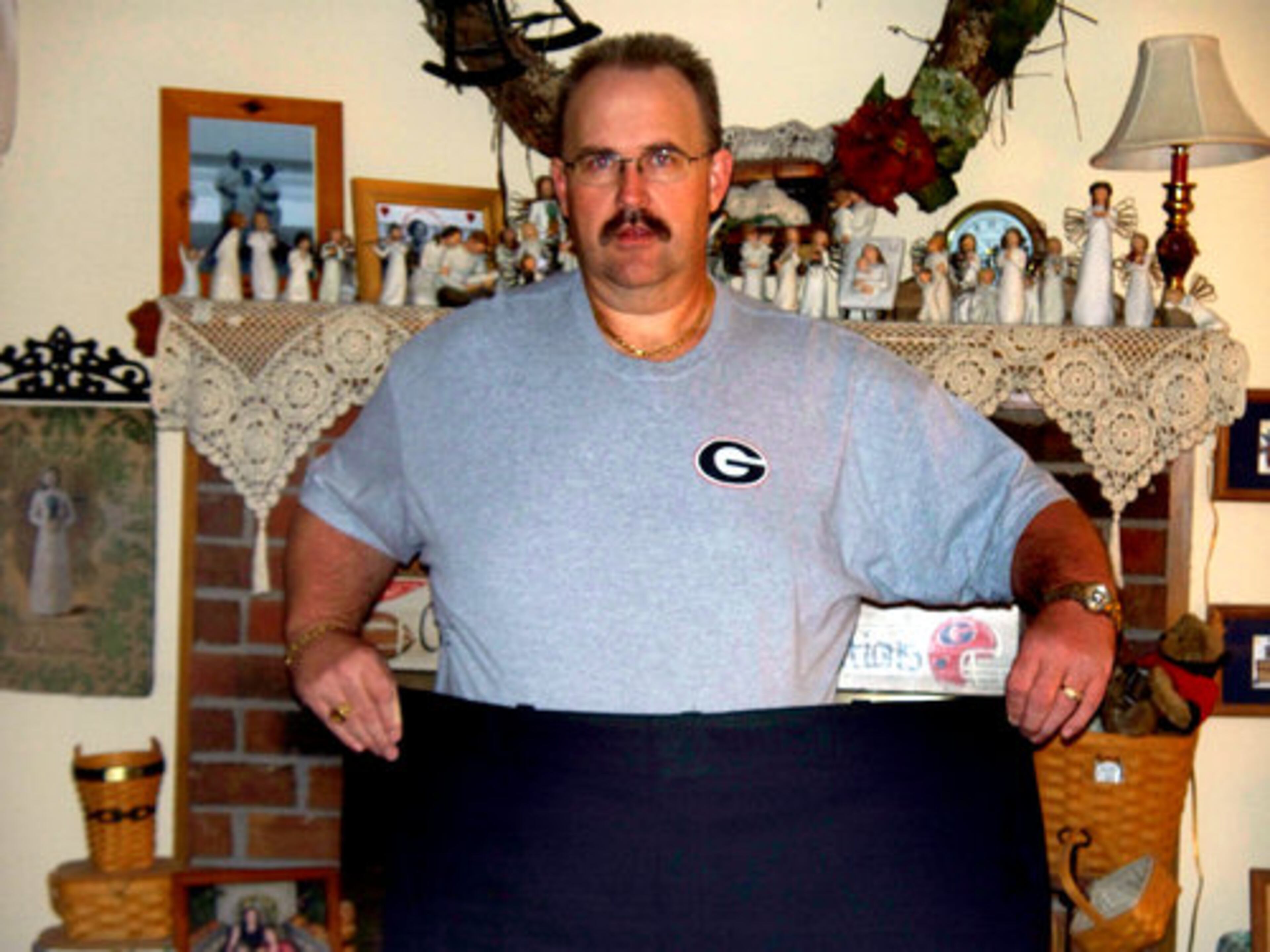 TOMMY ORR: Result: 326 lbs. (lost 94) On his success: "The biggest thing is getting your mind right and deciding for yourself that you want to do this."