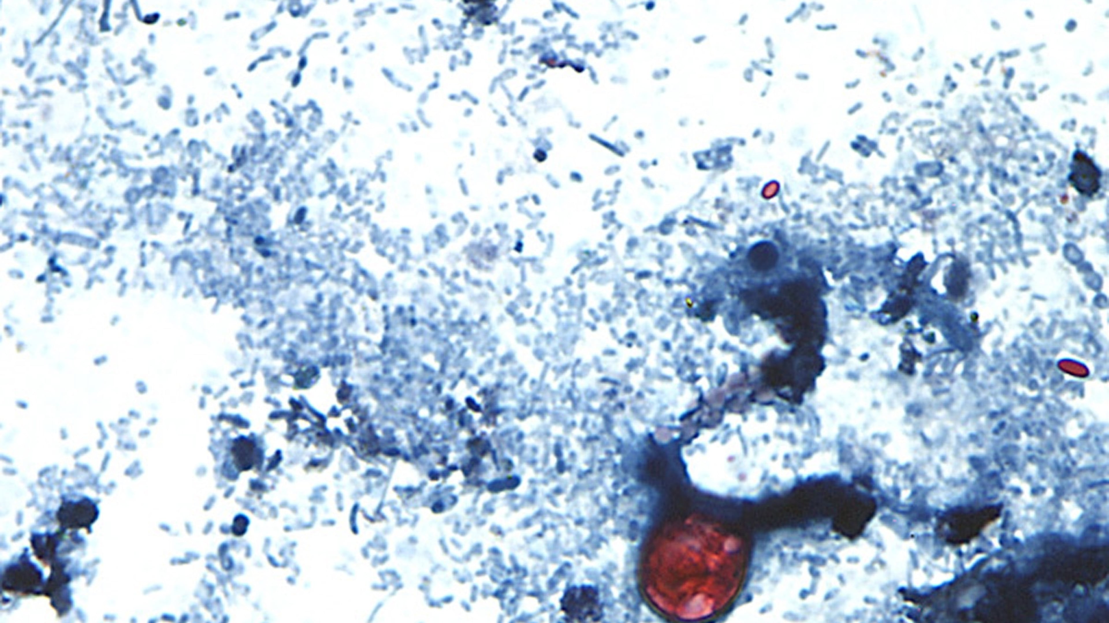 This undated photo taken through a microscope provided by the CDC shows Cyclospora cayetanensis oocysts found in a fresh stool sample which had been prepared with a formalin solution and stained with safranin. (CDC via AP)