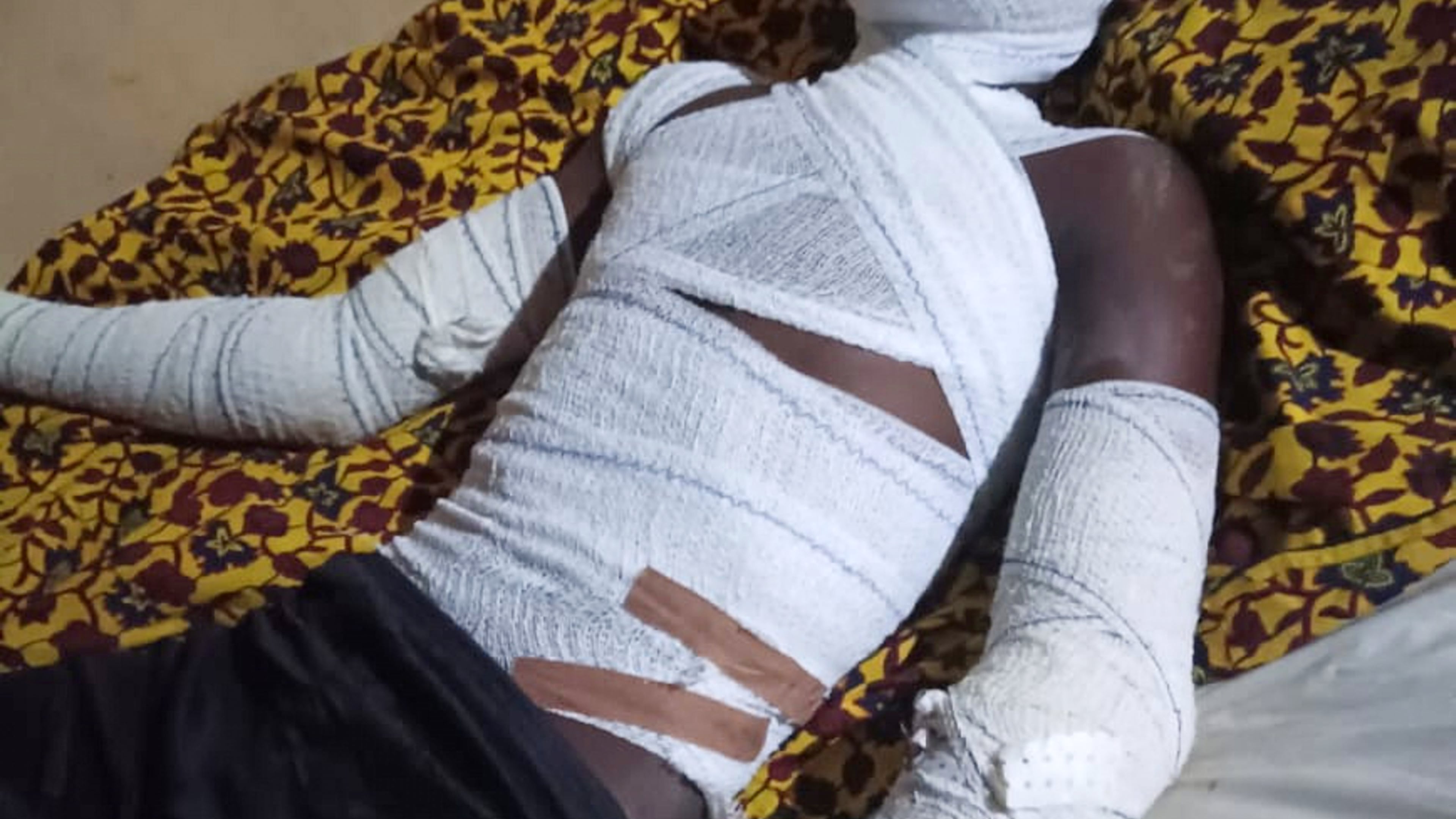 In this photo released by Amnesty International Nigeria, a patient receives treatment at the Yariman Bakura Specialist hospital in Gusau, Nigeria, Monday, May 11, 2026, after a Nigerian military airstrike struck a market on Sunday. (Amnesty International Nigeria Via AP)