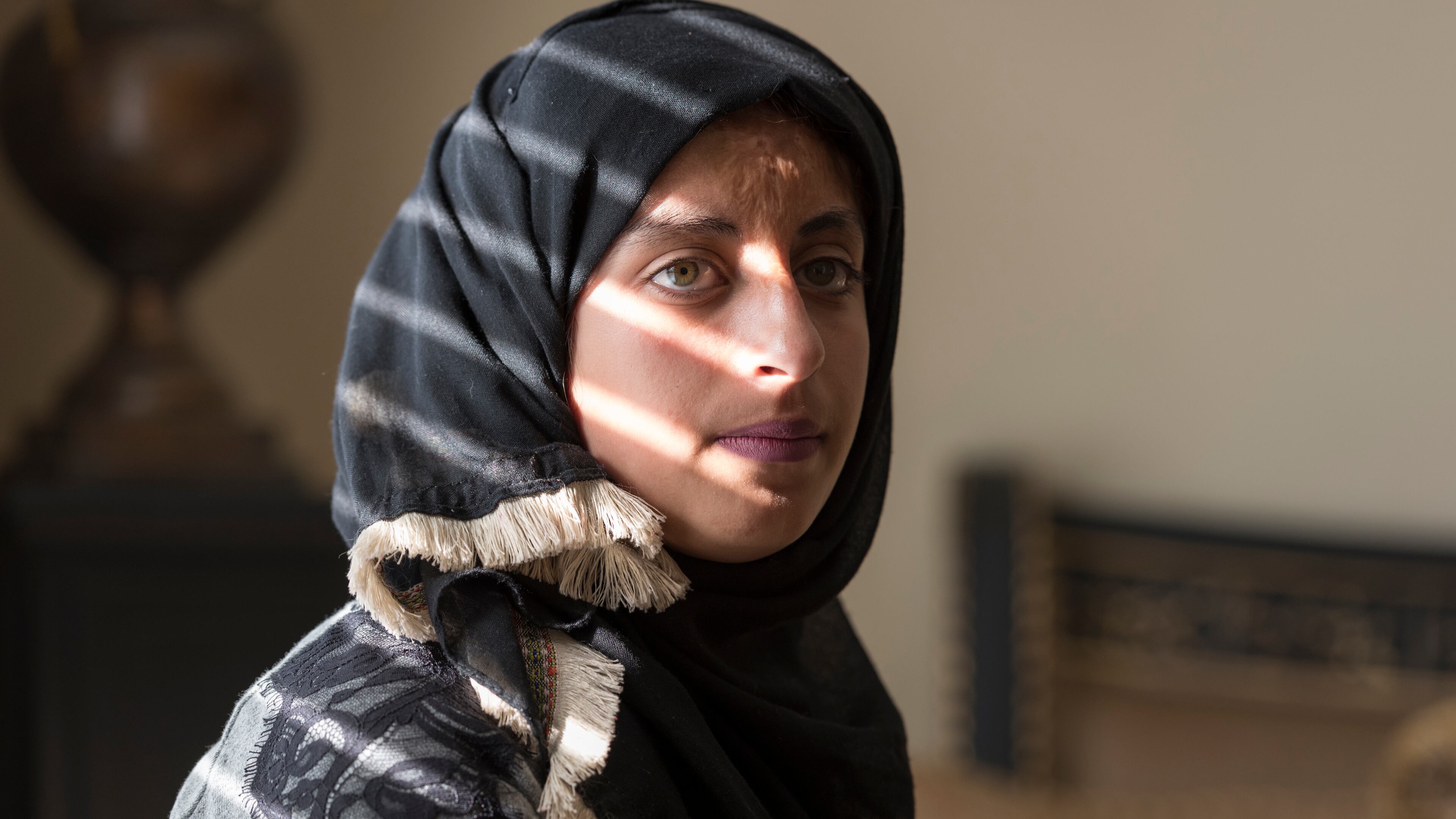November 9, 2016, Suwanee - Anwar Barash, an 18-year-old Palestinian, poses for a portrait in Suwanee, Georgia, on Wednesday, November 9, 2016. Barash is being treated for burns she received when she was 3 years old through efforts by the Palestine Childrenâs Relief Fund. (DAVID BARNES / DAVID.BARNES@AJC.COM)