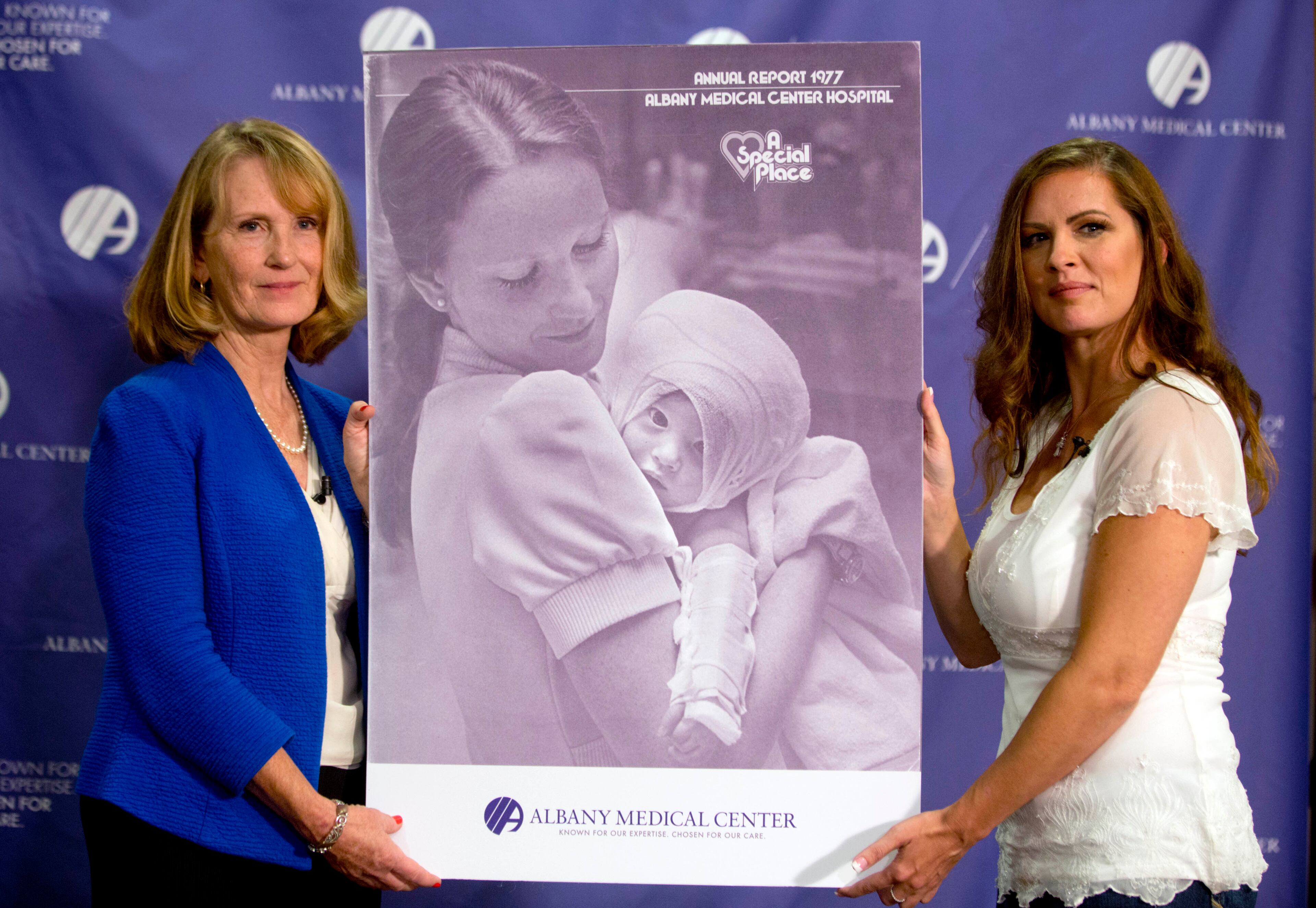 Nurse Susan Berger, left, and Amanda Scarpinati pose with a copy of a 1977 Albany Medical Center annual report during a news conference at Albany Medical Center on Sept. 29, 2015, in Albany, N.Y. Scarpinati, who suffered severe burns as an infant, is finally getting the chance to thank Berger who cared for her, thanks to a social media posting that revealed the identity of the nurse in 38-year-old photos.
