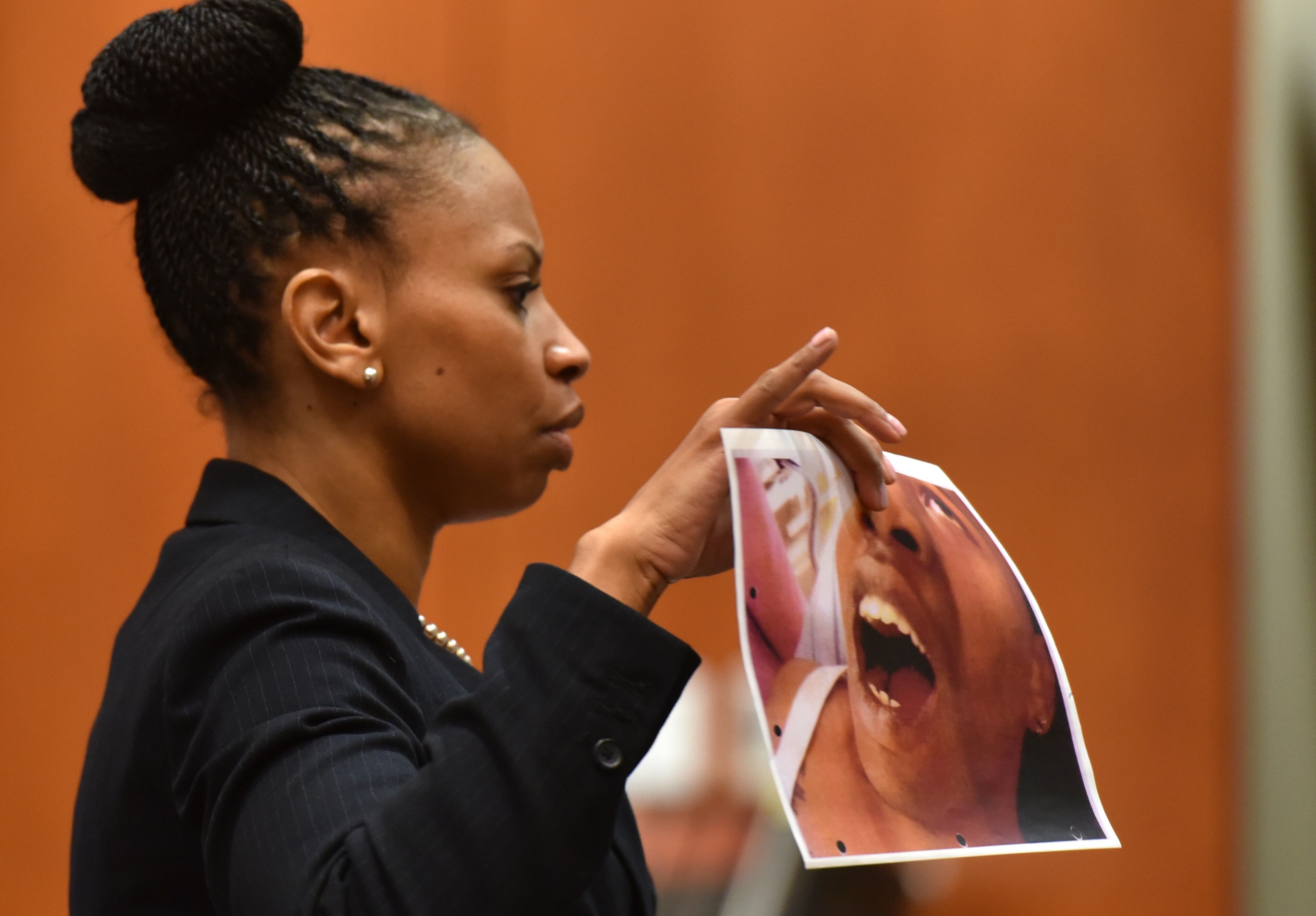 Feb. 18, 2016 Decatur, GA: Prosecutor Buffy Thomas shows the jury a photo of Tavarrius Williams' chipped tooth during the trial of former DeKalb County Police Sgt. Anthony Remone Robinson. Robinson is charged with ordering the beating of a burglary suspect. (UPDATE: On Friday, Feb. 26, Robinson was found guilty on six counts but avoided conviction on the most serious charges.) BRANT SANDERLIN/BSANDERLIN@AJC.COM