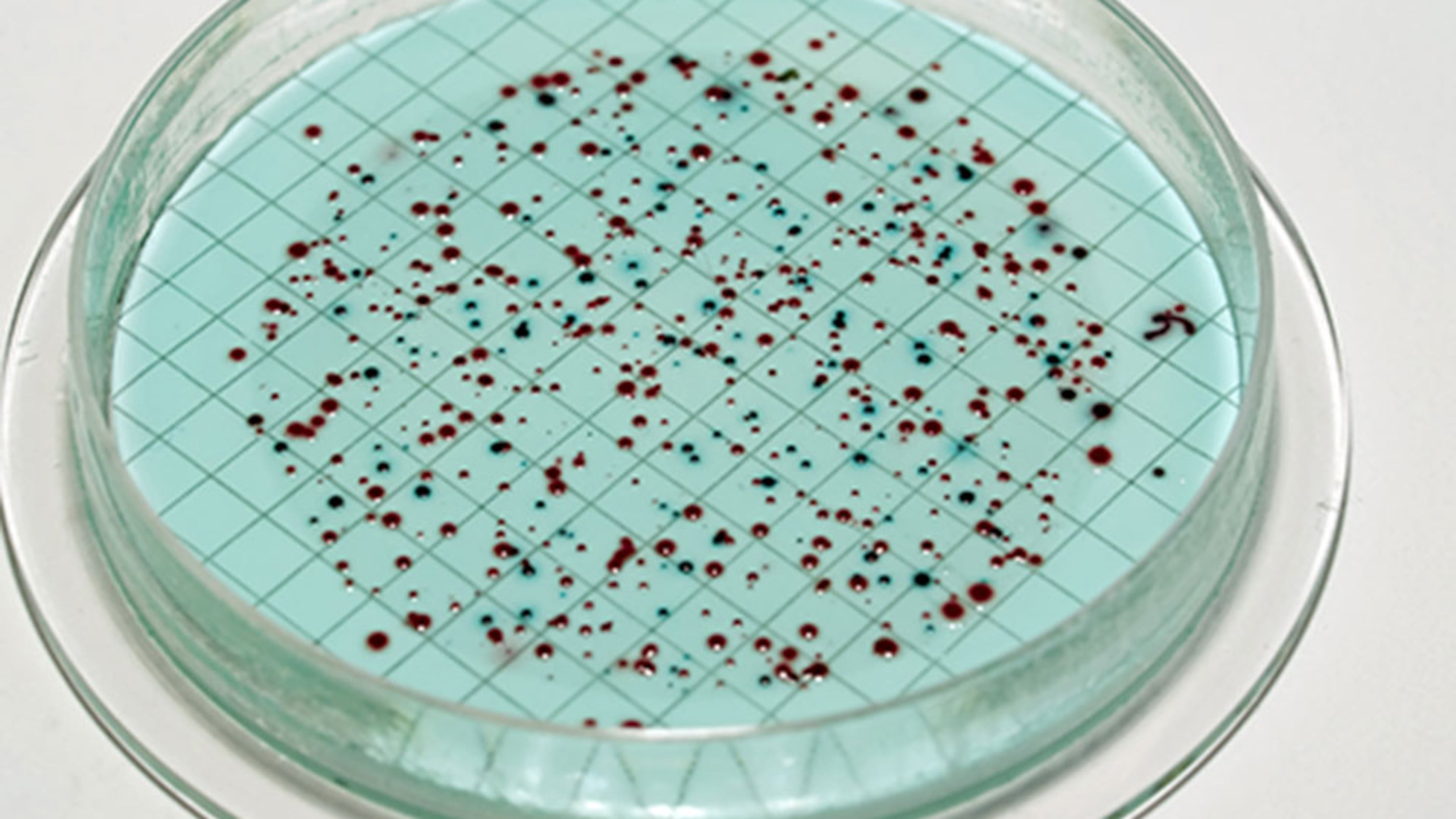 Bacteria come in many forms, but Vibrio vulnificus, a rare and potentially deadly bacteria found in warm salt water has prompted health officials to warn those who venture into Florida's waters to be wary, especially if you have any open cuts.