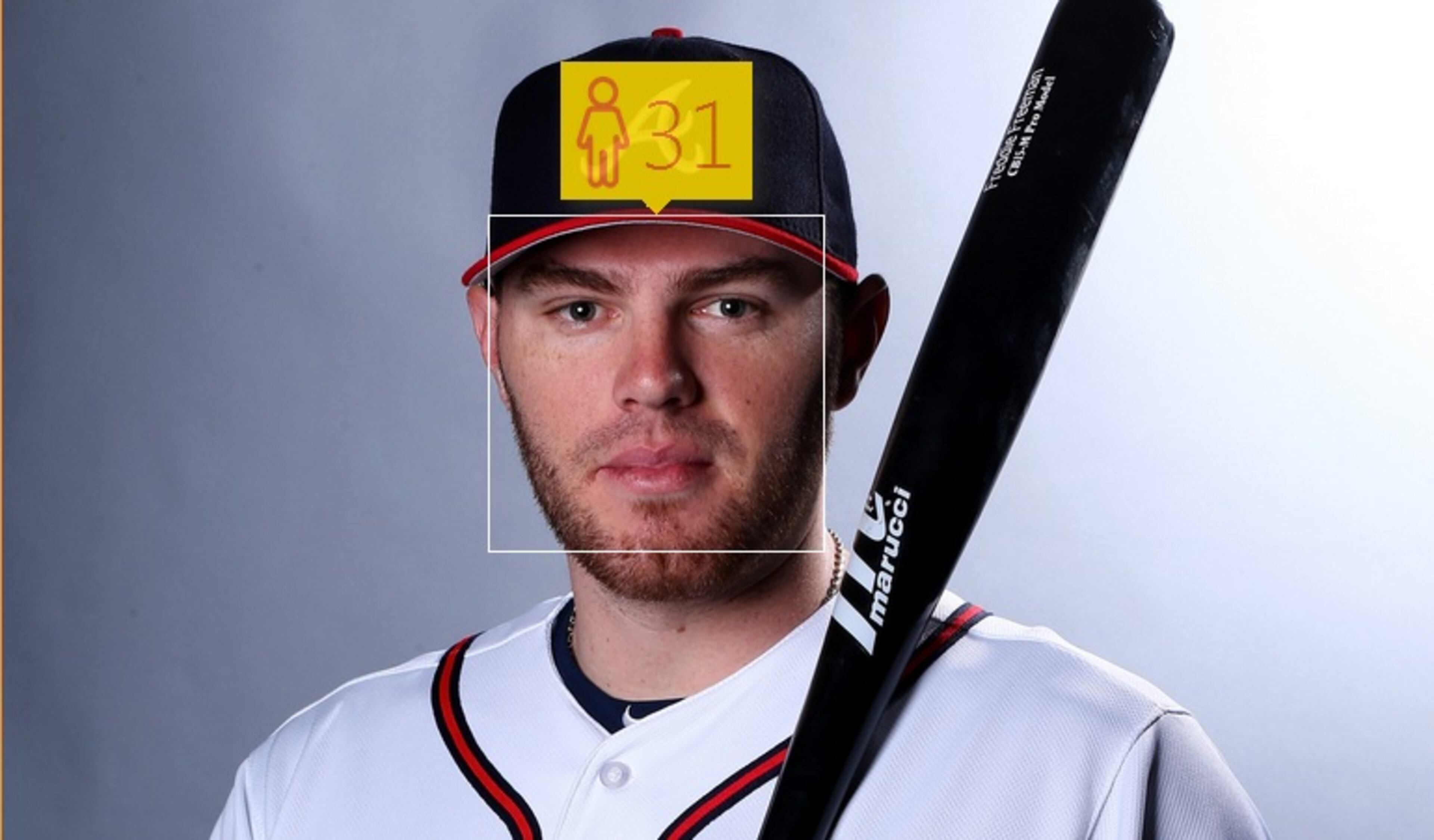 Atlanta Braves player Freddie Freeman is 25. How Old thinks he looks 31.