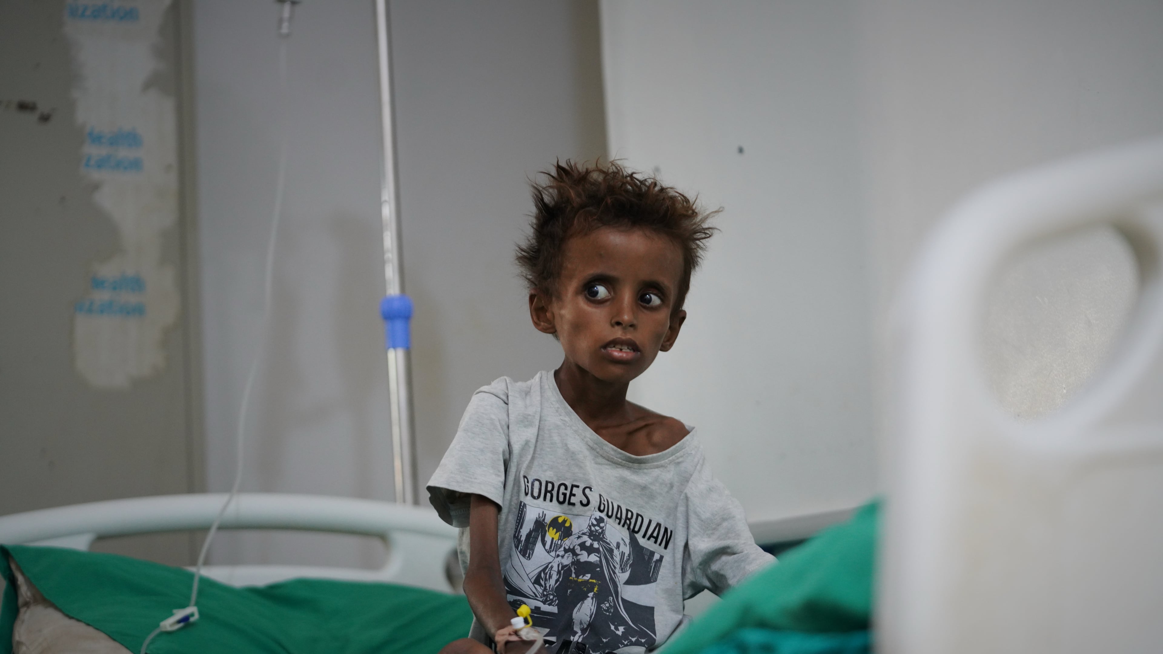 Tarek al-Salami, 7, who was displaced from the city of Mokha and is showing symptoms of malnutrition, sits on a bed while receiving treatment at a therapeutic feeding center in Buraiqa, on the western outskirts of Aden, Yemen, Tuesday, Sept. 22, 2026. (AP Photo/Abdulnasser Alseddik)