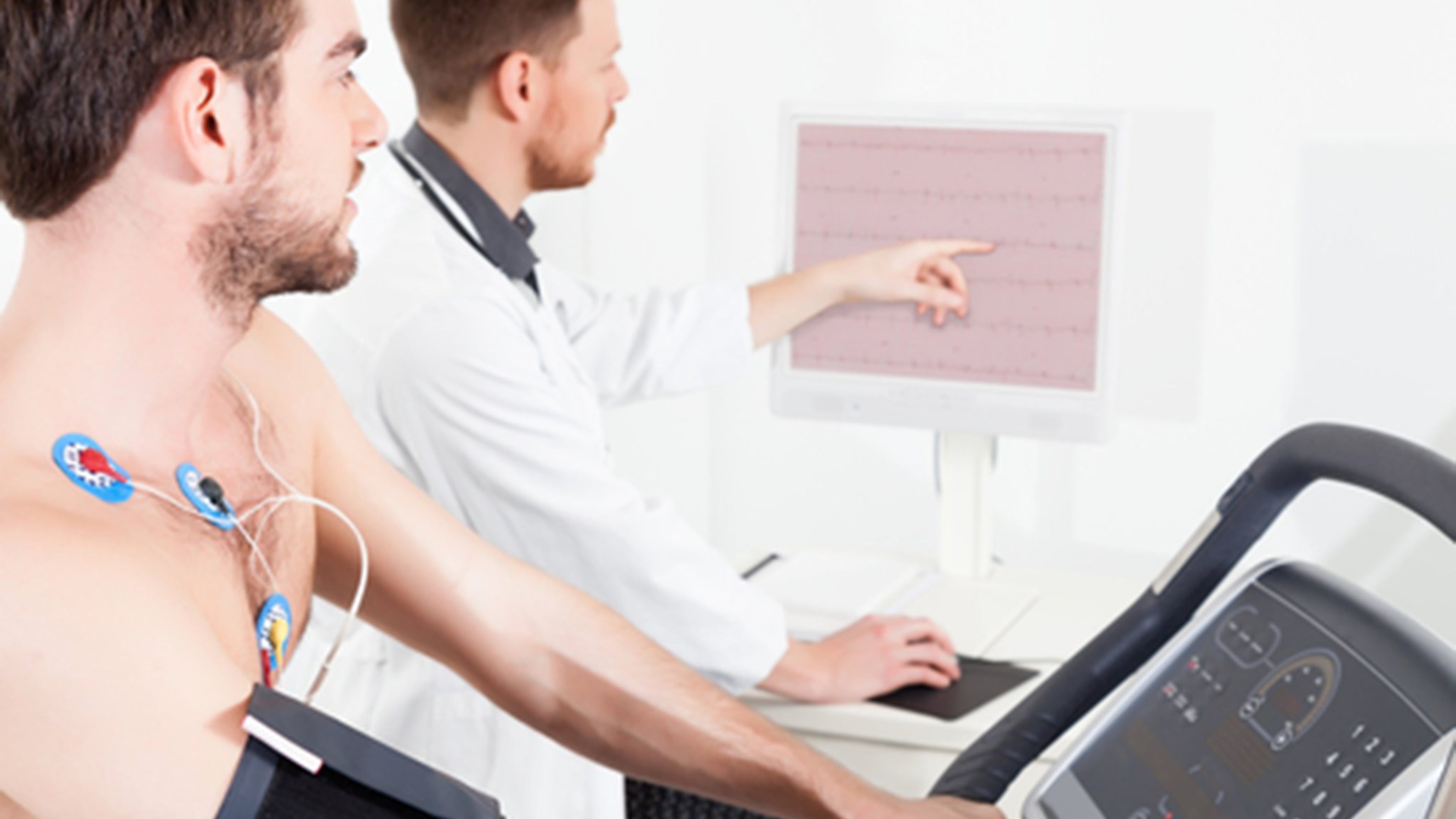Cardiac stress test ECG Tracings (Dreamstime/TNS)