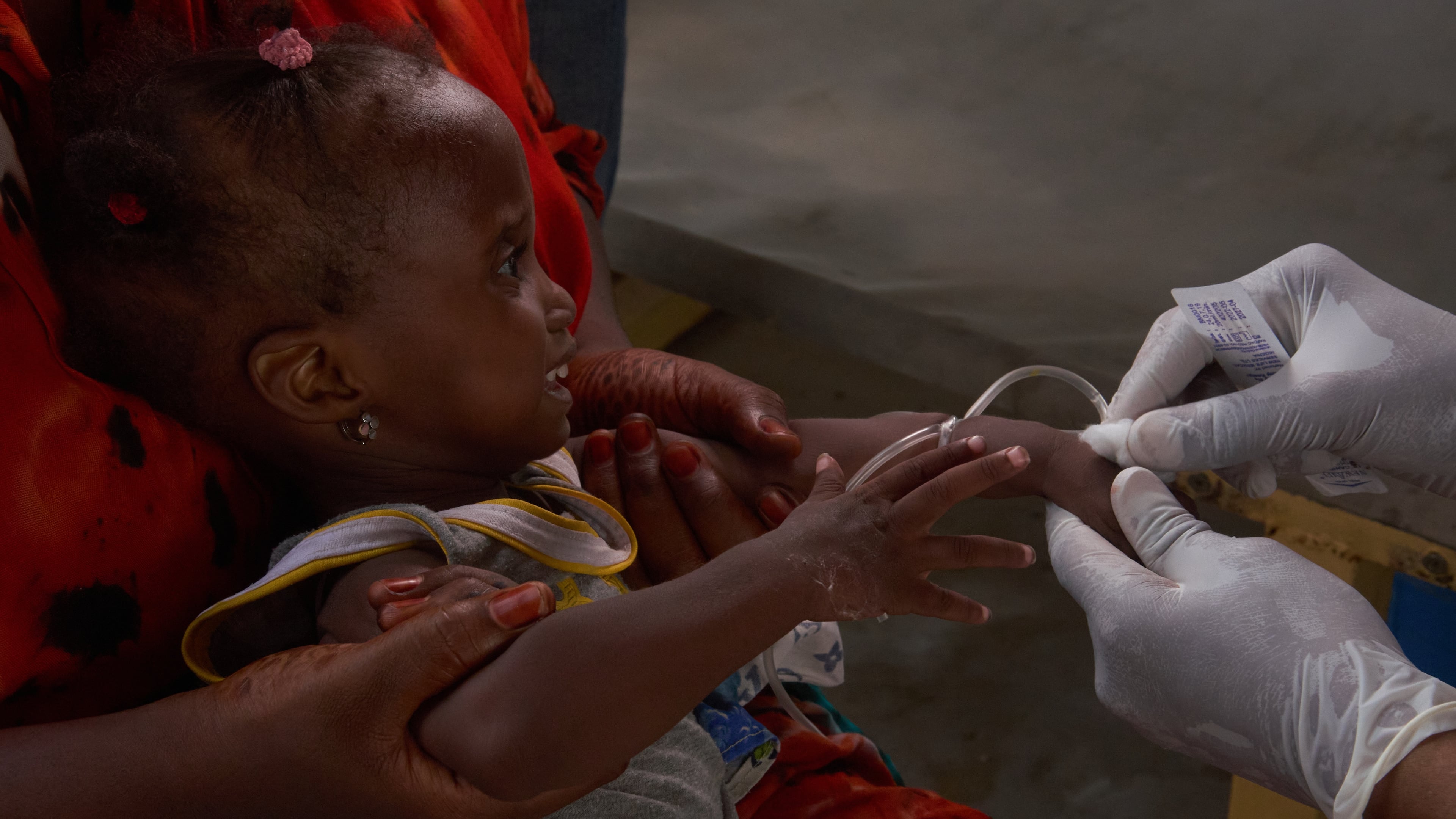 A child suffering from cholera has a blood sample taken at the MSF treatment centre in Maiduguri, Nigeria, Monday, June 8, 2026. (AP Photo/Jude Mike)