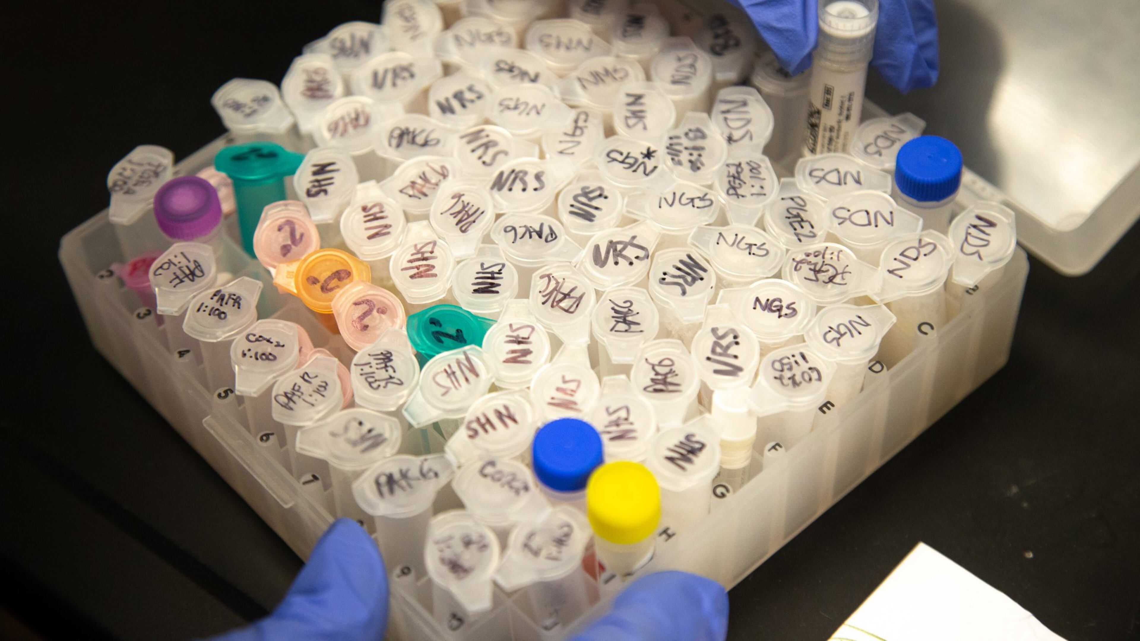 University-led research can lead to lifesaving treatments. Here, a student handles samples for bladder cancer research. (AJC 2020)