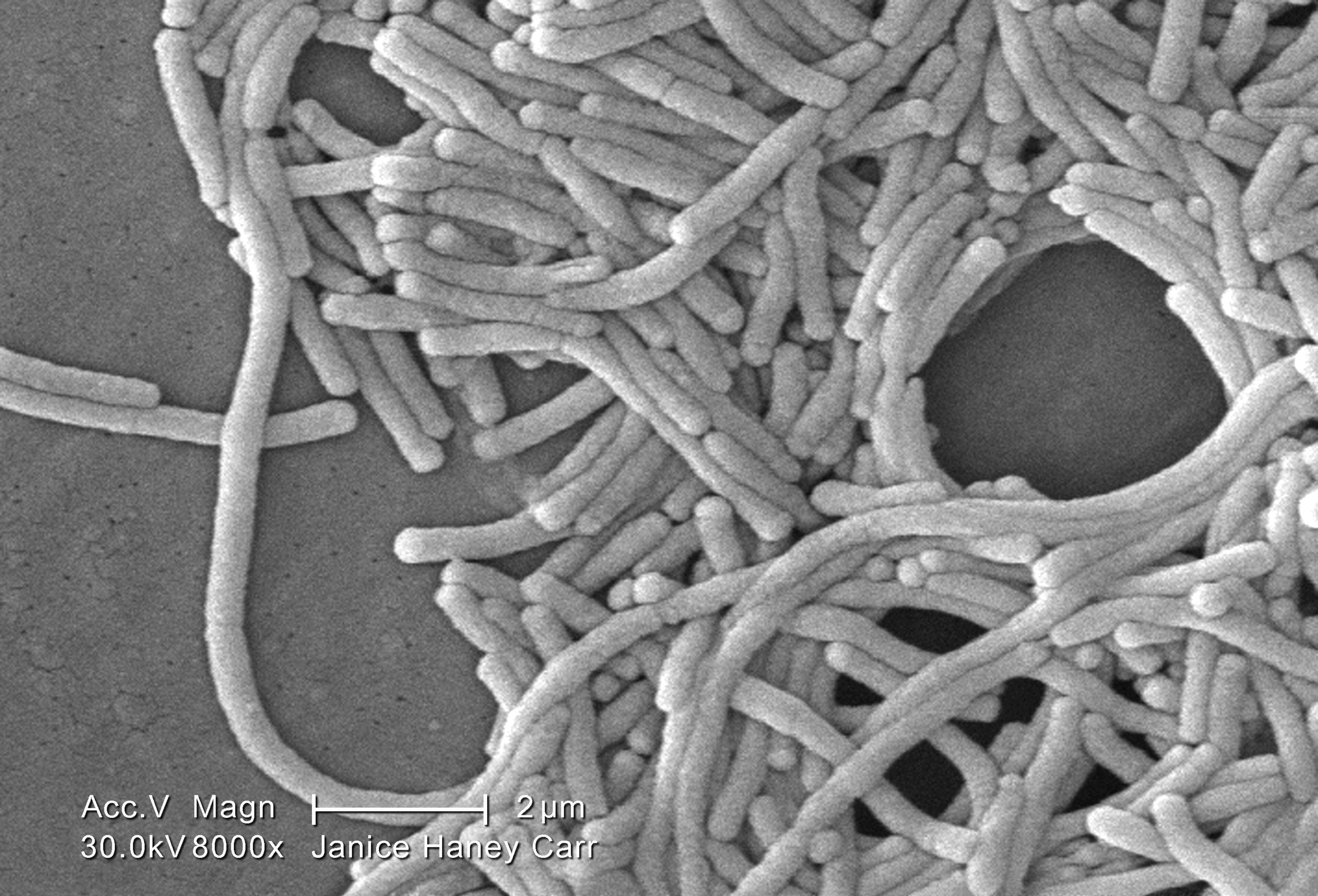 A large grouping of Gram-negative Legionella pneumophila bacteria is shown here at 8000X magnification. "After Legionella grows and multiplies in a building water system, that contaminated water then has to spread in droplets small enough for people to breathe in. People are exposed to Legionella when they breathe in mist (small droplets of water in the air) containing the bacteria. One example might be from breathing in droplets sprayed from a hot tub that has not been properly cleaned and disinfected," the CDC notes.