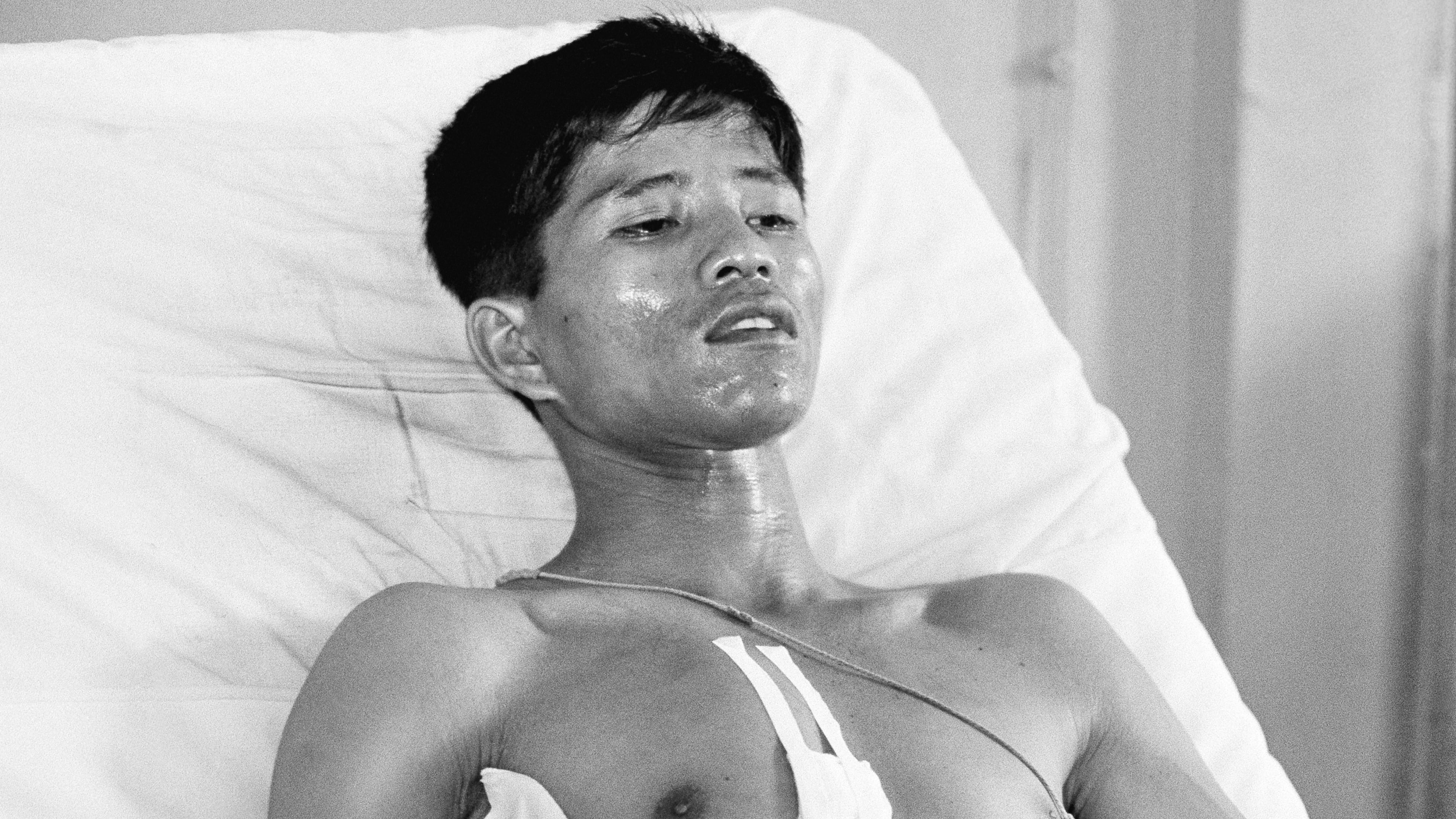 FILE - Dang Van Phuoc, 22, a Vietnamese photographer working with the Associated Press, lies in a bed at the Vietnamese Military Hospital at Can Tho, Vietnam, 80 miles south of Saigon, March 19, 1969, after he was seriously injured during intense combat. (AP Photo/Al Chang, File)