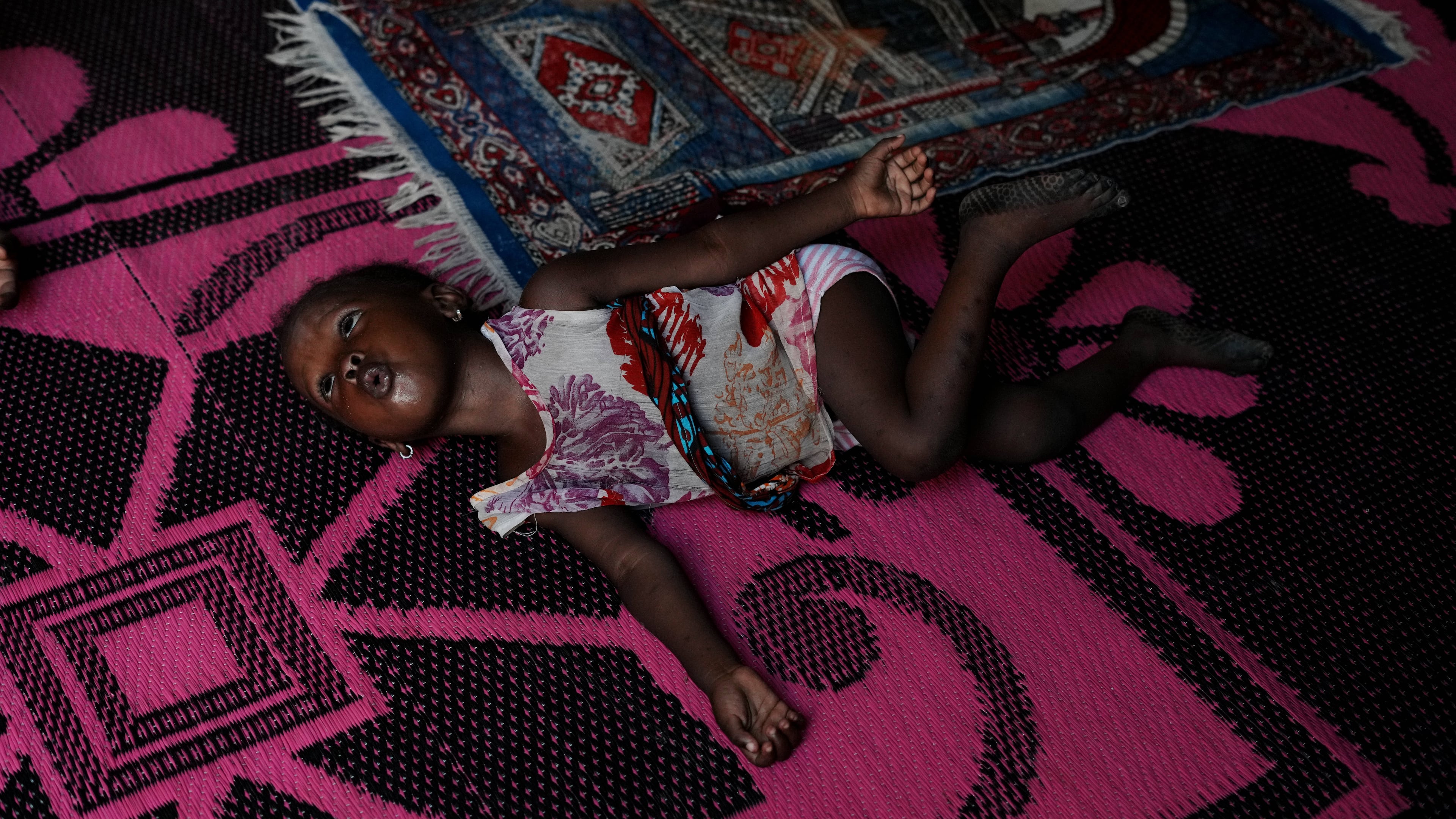Farisa, who has relapsed into malnutrition, plays on a mat inside her house in Kware Sokoto, northwestern Nigeria, Wednesday, July 15, 2026. (AP Photo/Sunday Alamba)