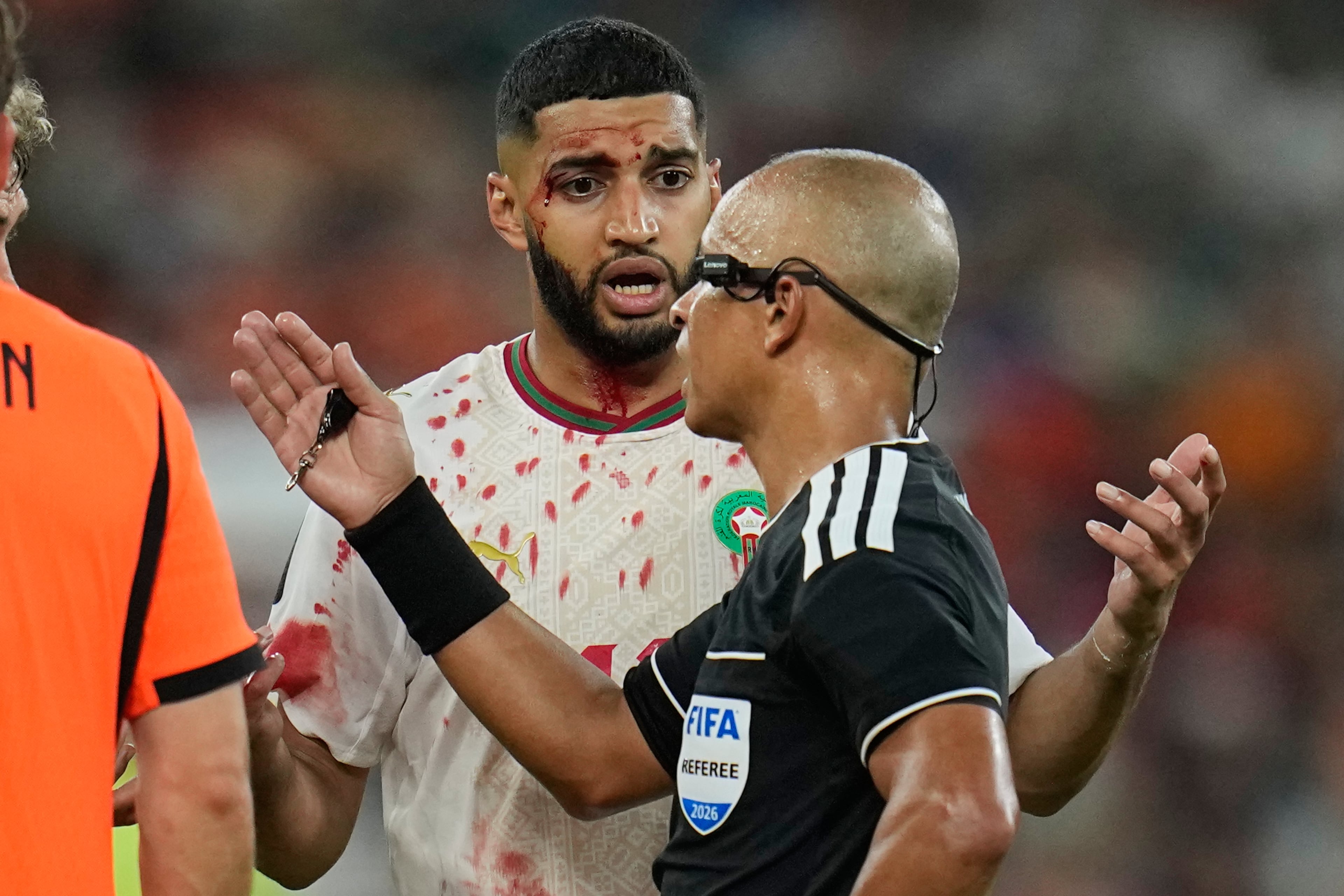 Head injuries are always dramatic, as Morocco's Ismael Saibari illustrated. (Ricardo Mazalan/AP)
