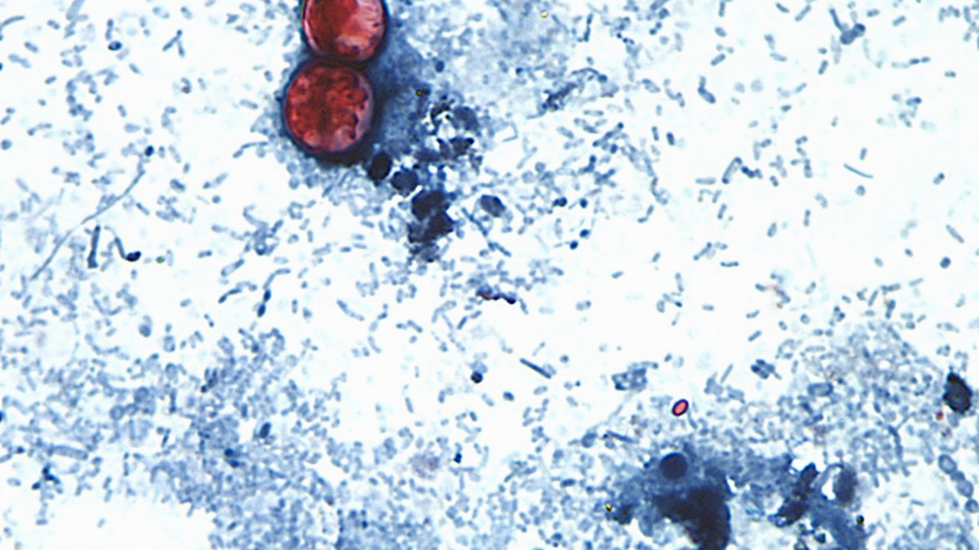 FILE - This undated photo taken through a microscope provided by the CDC shows Cyclospora cayetanensis oocysts found in a fresh stool sample which had been prepared with a formalin solution and stained with safranin. (CDC via AP, File)