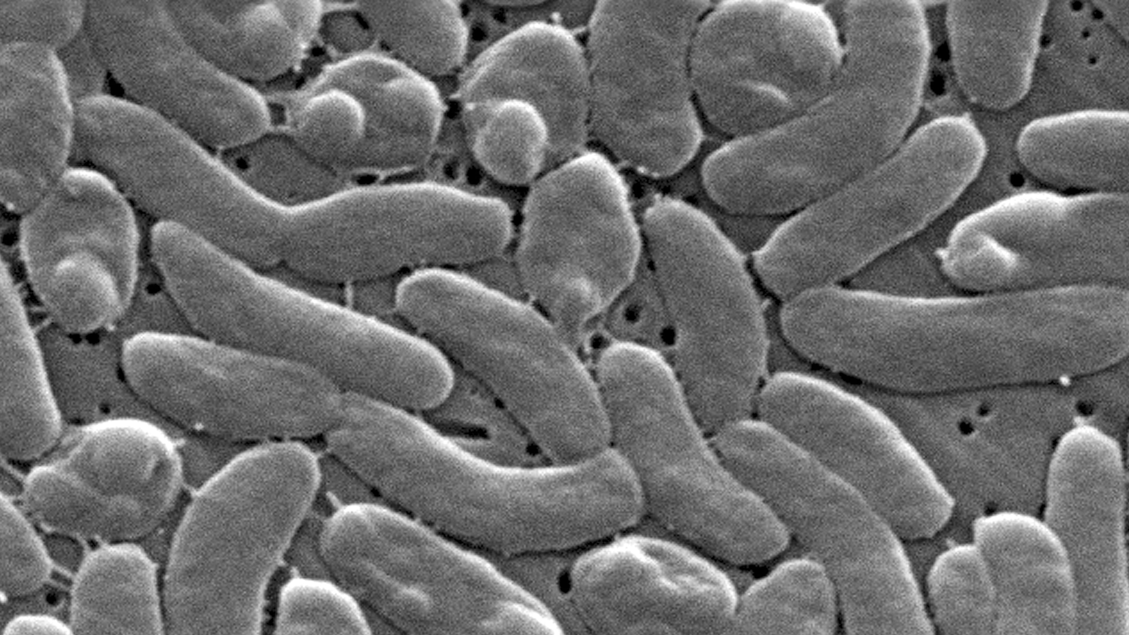 FILE - This 2005 electron microscope image provided by the Centers for Disease Control and Prevention shows Vibrio vulnificus bacteria. (Janice Haney Carr/Centers for Disease Control and Prevention via AP, File)