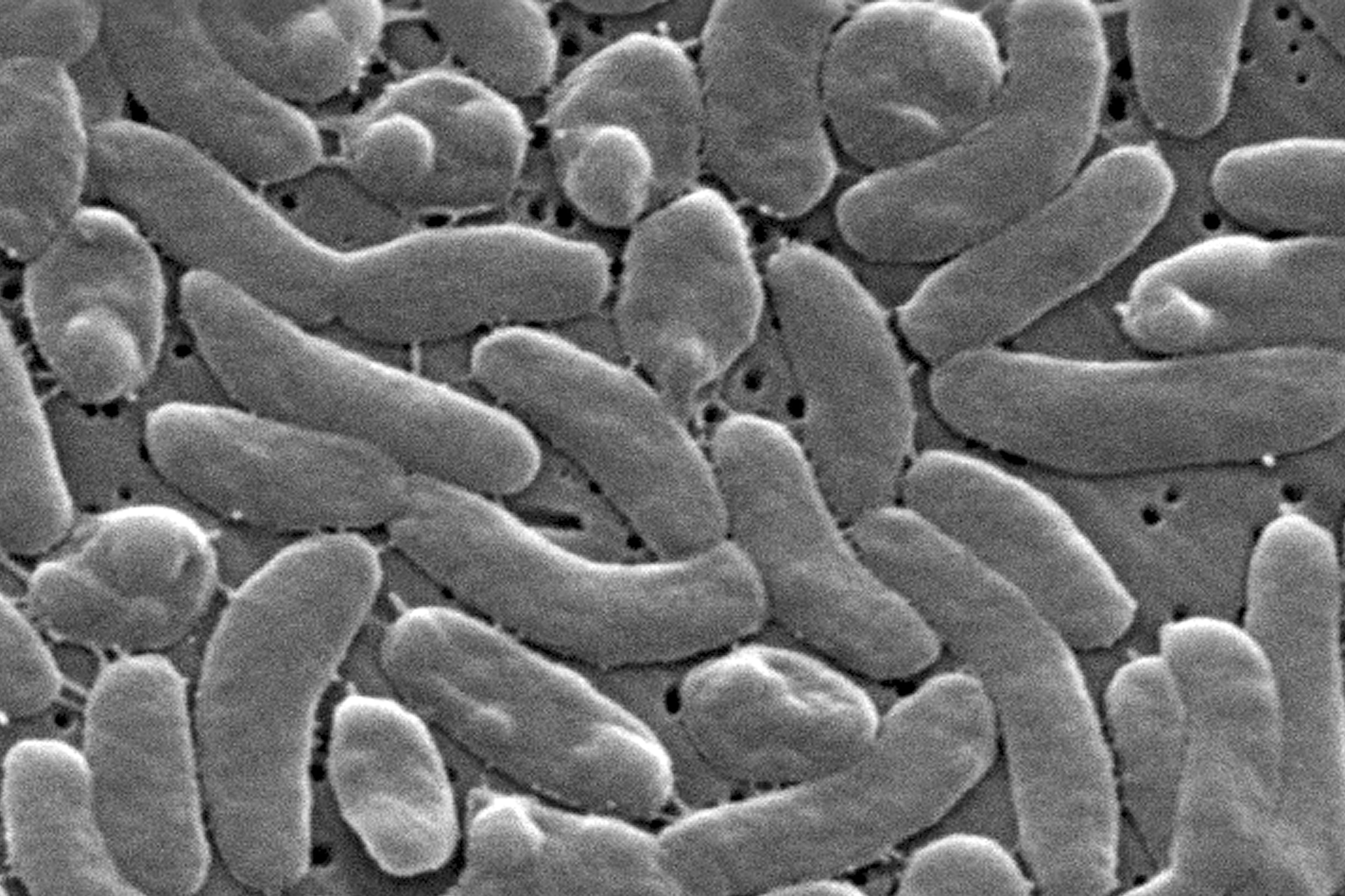 Vibrio bacteria are typically found in warm, brackish water near the coast and could result in medical conditions from diarrhea to limb infections. (Janice Haney Carr/Centers for Disease Control and Prevention via AP 2005)
